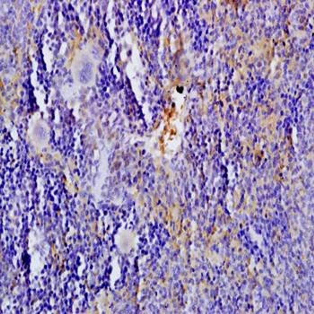 Immunohistochemical analysis of formalin-fixed and paraffin embedded rat spleen tissue (dilution at:1:200) using 5-HTT antibody