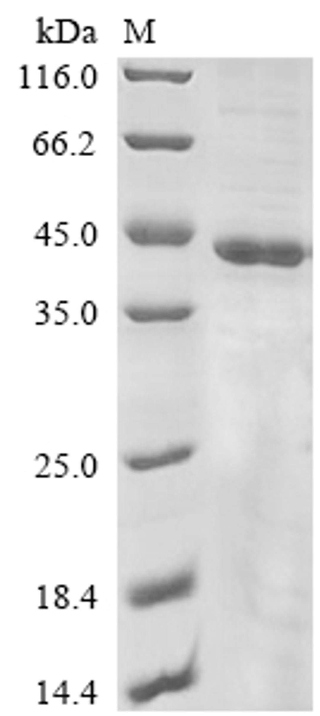 (Tris-Glycine gel) Discontinuous SDS-PAGE (reduced) with 5% enrichment gel and 15% separation gel.