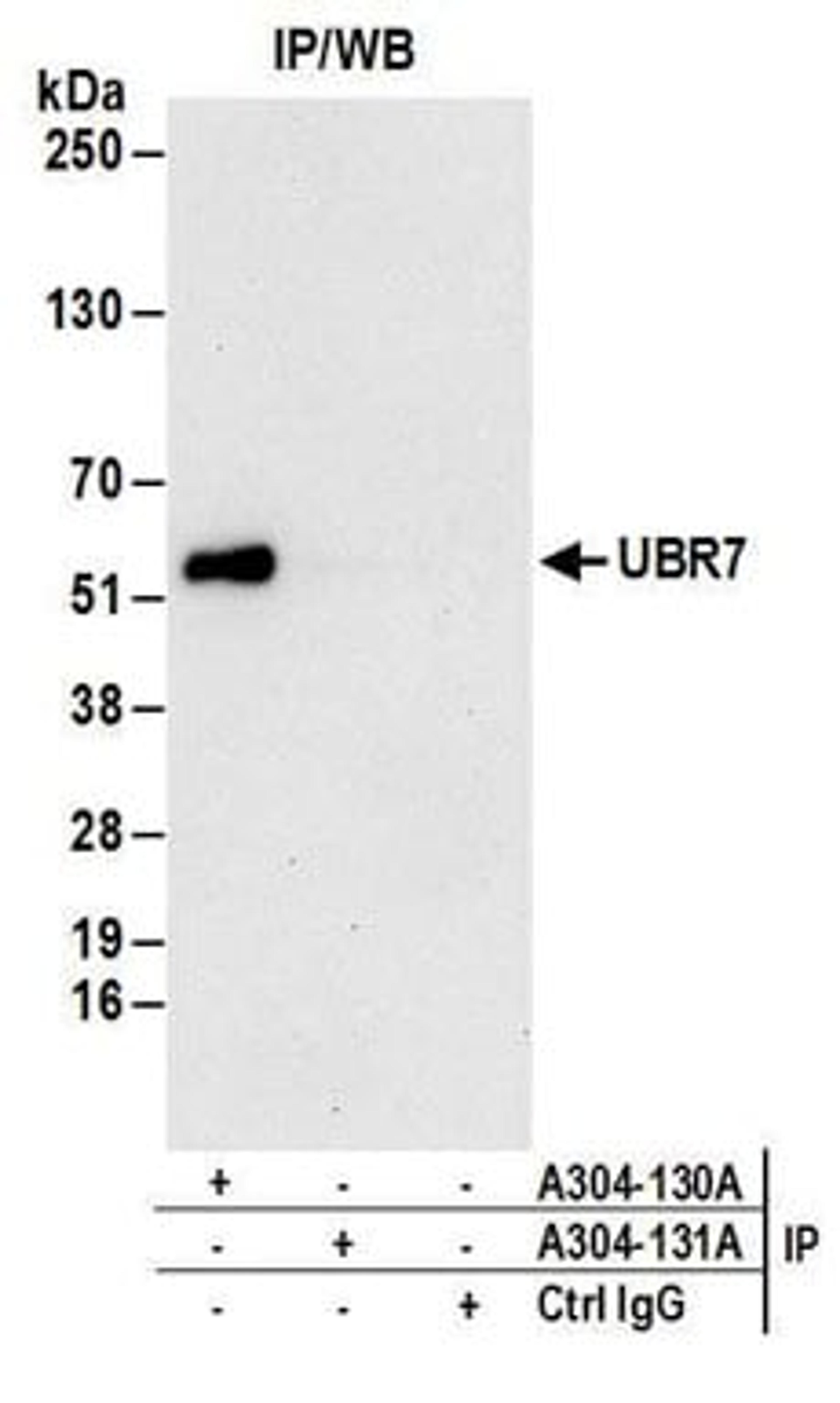 Detection of human UBR7 by western blot of immunoprecipitates.