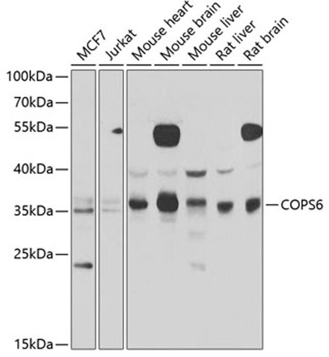 Western blot - COPS6 antibody (A7072)