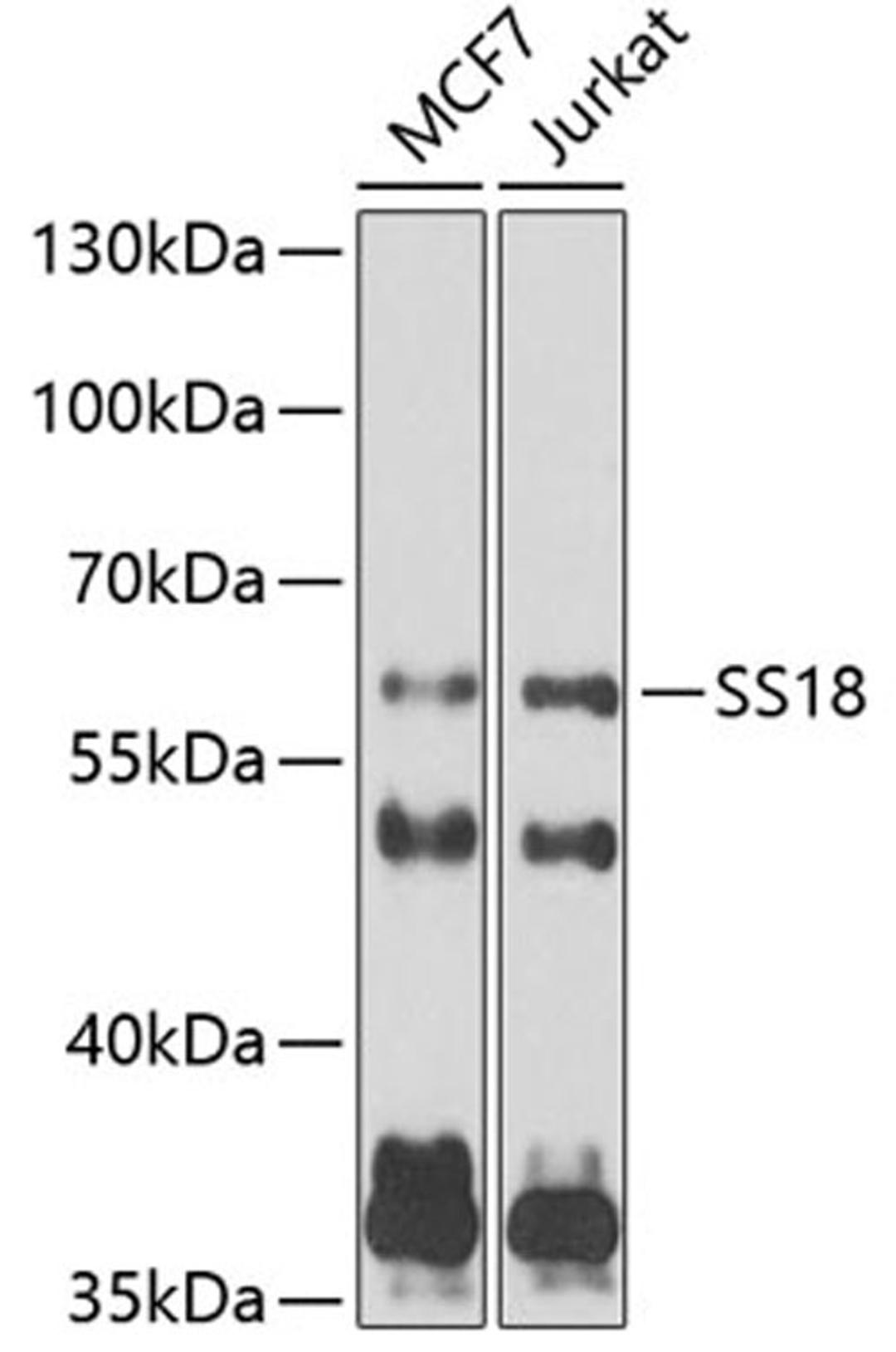 Western blot - SS18 antibody (A6990)