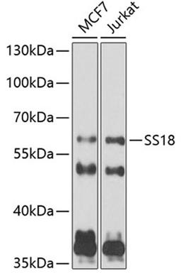 Western blot - SS18 antibody (A6990)