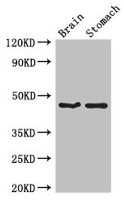 Western Blot. Positive WB detected in: Mouse brain tissue, Mouse stomach tissue. All lanes: TBC1D20 antibody at 4ug/ml. Secondary. Goat polyclonal to rabbit IgG at 1/50000 dilution. Predicted band size: 46, 20, 49 kDa. Observed band size: 46 kDa. 