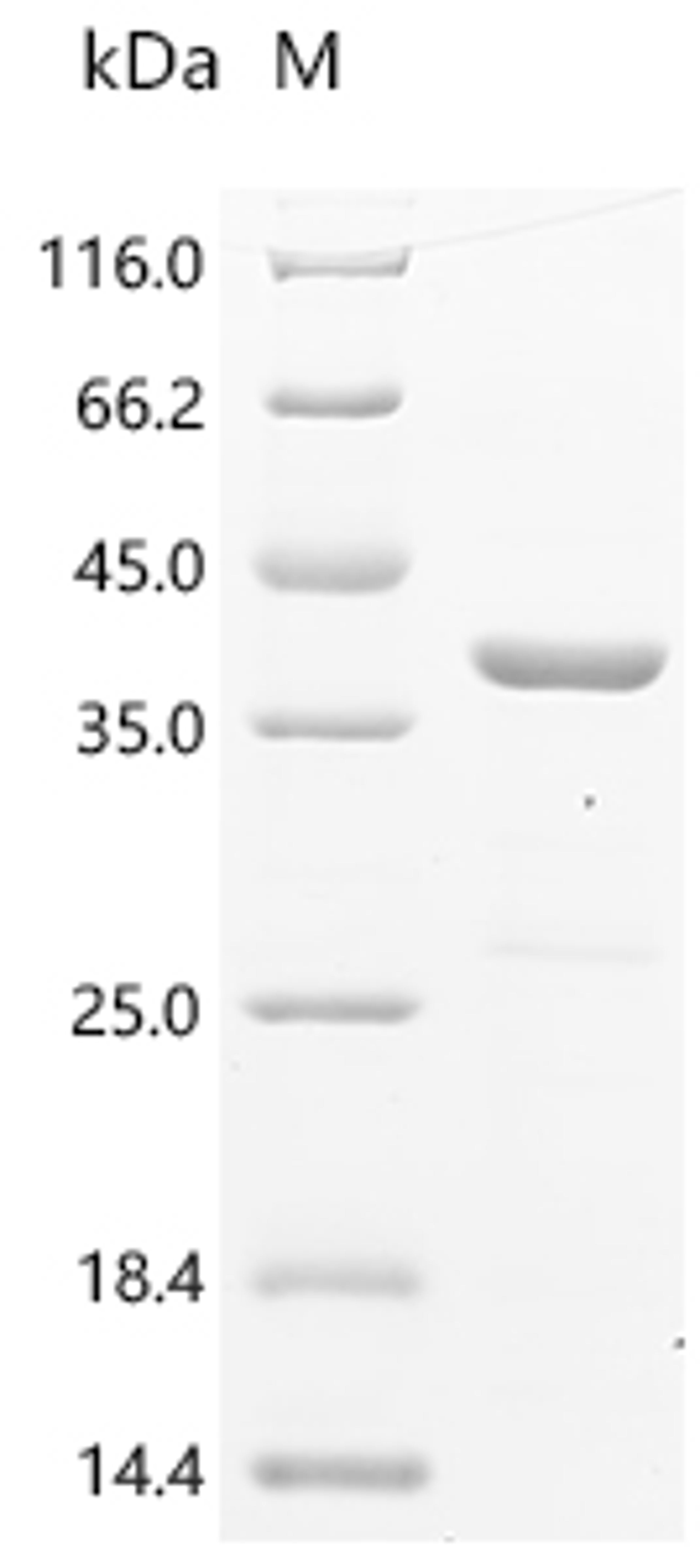 (Tris-Glycine gel) Discontinuous SDS-PAGE (reduced) with 5% enrichment gel and 15% separation gel.