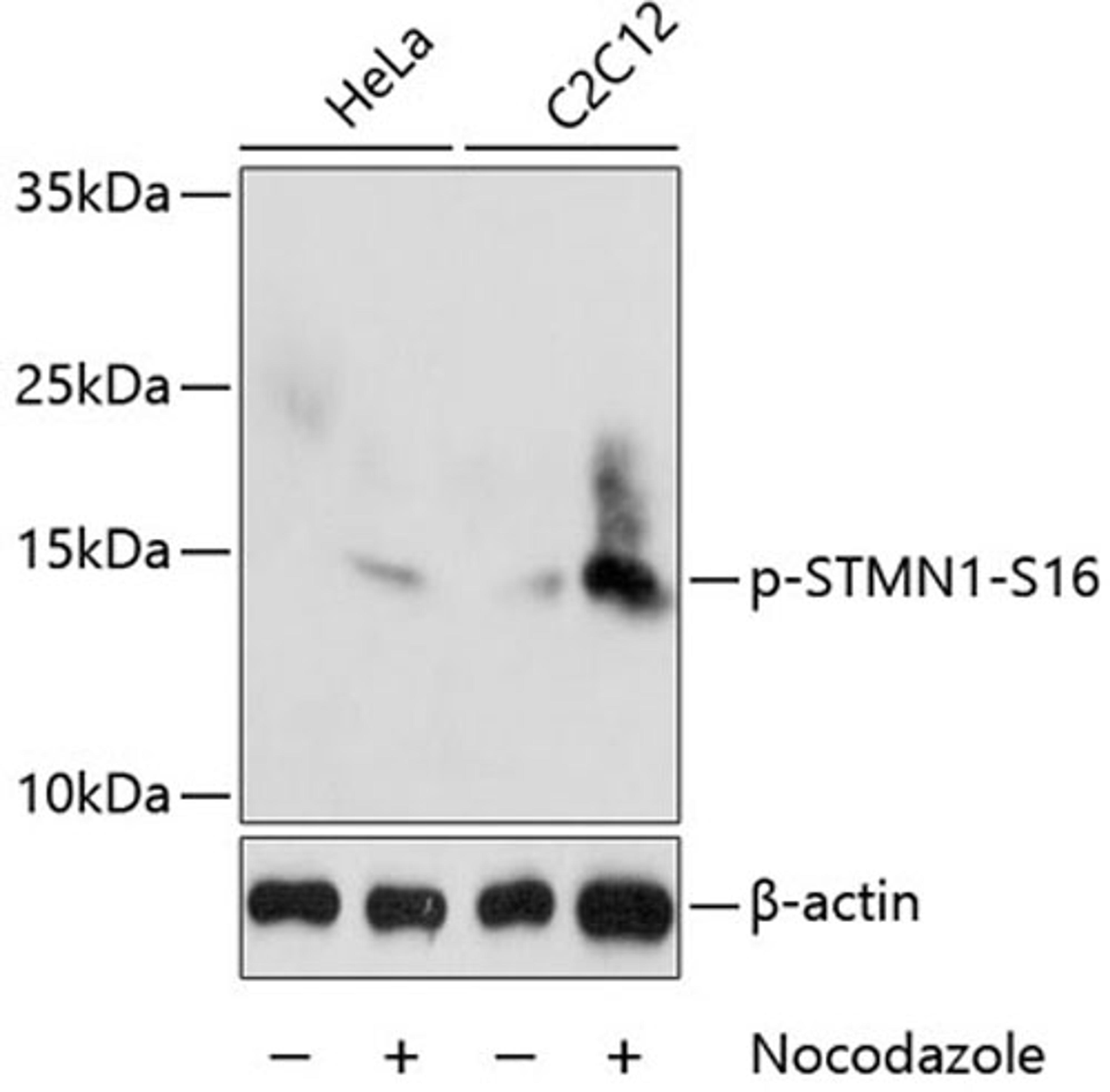 Western blot - Phospho-STMN1-S16 antibody (AP0229)