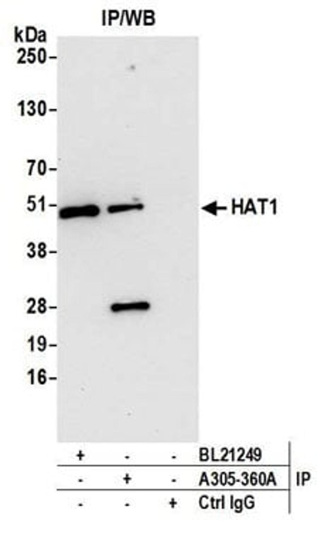 Detection of human HAT1 by western blot of immunoprecipitates.