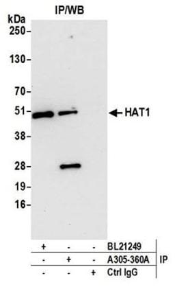 Detection of human HAT1 by western blot of immunoprecipitates.