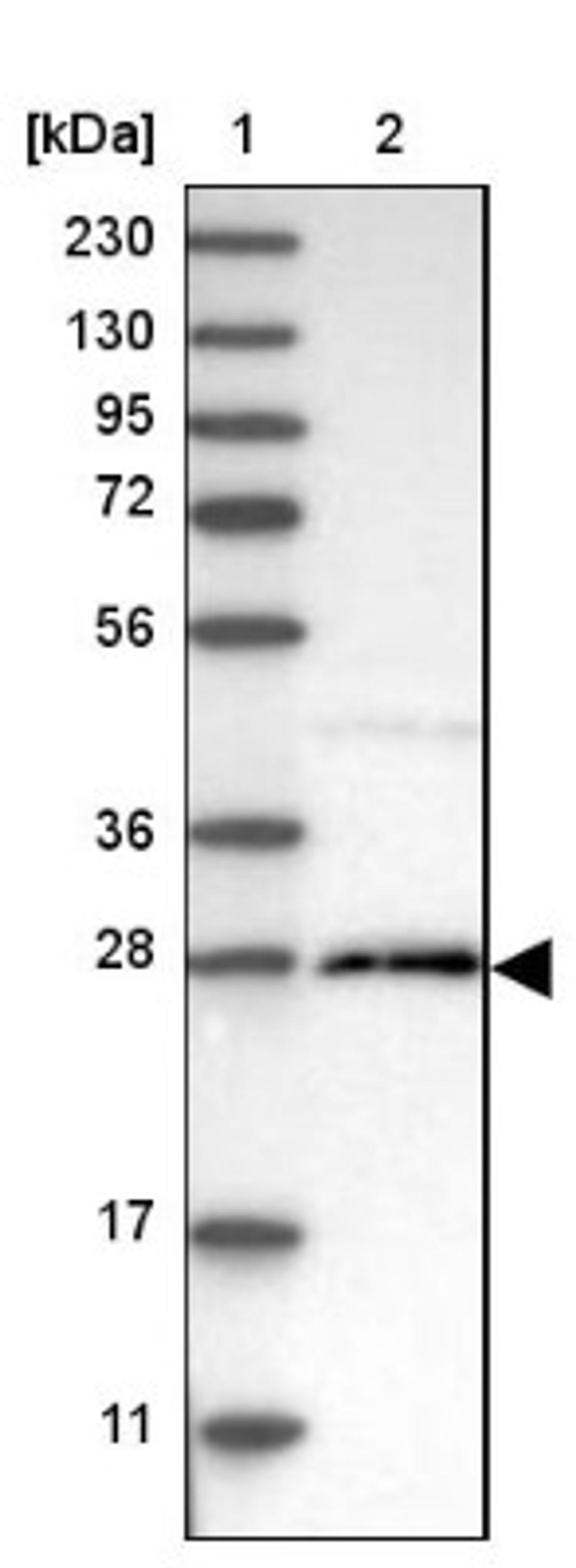 Western Blot: C22orf43 Antibody [NBP1-90938] - Lane 1: Marker [kDa] 230, 130, 95, 72, 56, 36, 28, 17, 11<br/>Lane 2: Human cell line RT-4