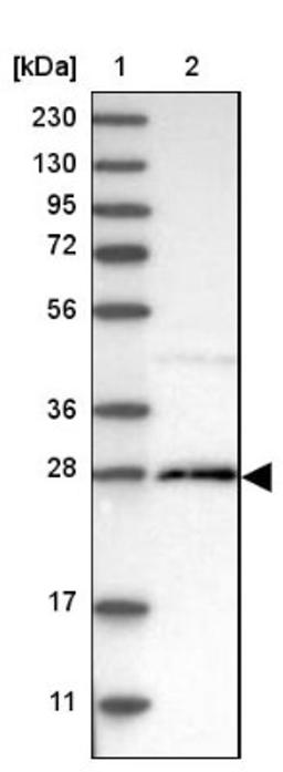 Western Blot: C22orf43 Antibody [NBP1-90938] - Lane 1: Marker [kDa] 230, 130, 95, 72, 56, 36, 28, 17, 11<br/>Lane 2: Human cell line RT-4