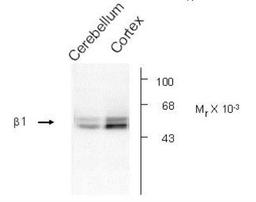 Western Blot: GABA-A R beta 1 Antibody [NB300-197] - Rat cerebellar (Cb) and hippocampal (Hipp) lysates showing specific immunolabeling of the ~55k beta 1-subunit of the GABA-A R beta 1 Antibody.