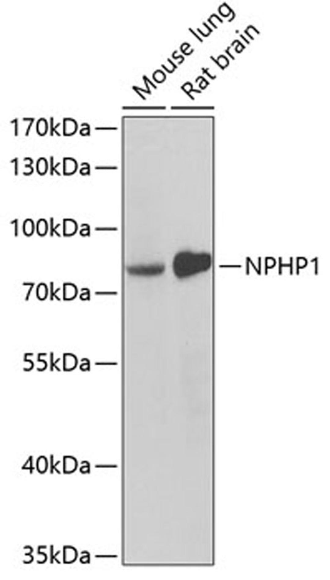 Western blot - NPHP1 antibody (A6674)