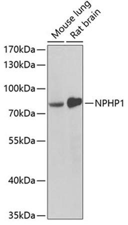 Western blot - NPHP1 antibody (A6674)