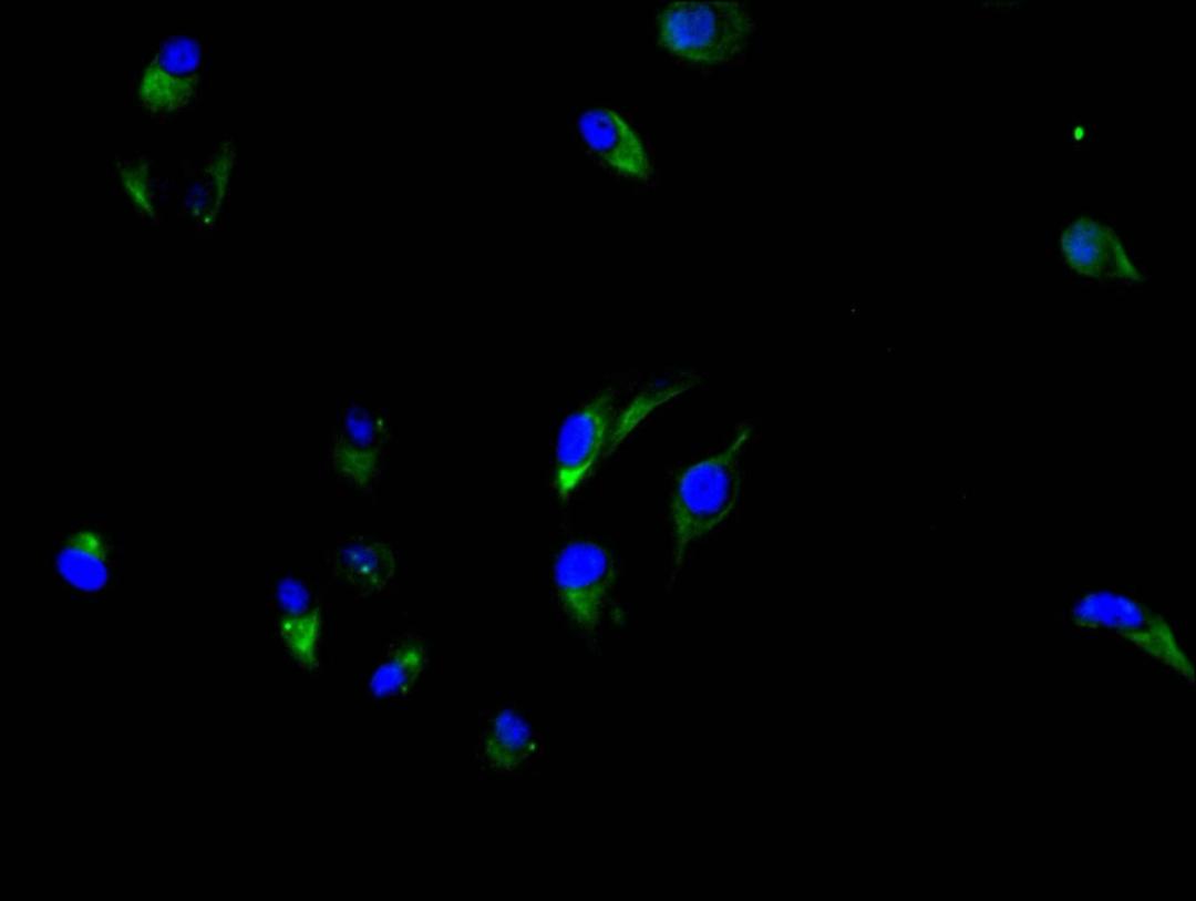 Immunofluorescence staining of Hela cell with CSB-RA005165MA3HU at 1:150, counter-stained with DAPI. The cells were fixed in 4% formaldehyde and blocked in 10% normal Goat Serum. The cells were then incubated with the antibody overnight at 4C. The secondary antibody was FITC-conjugated AffiniPure Goat Anti-human IgG(H+L).