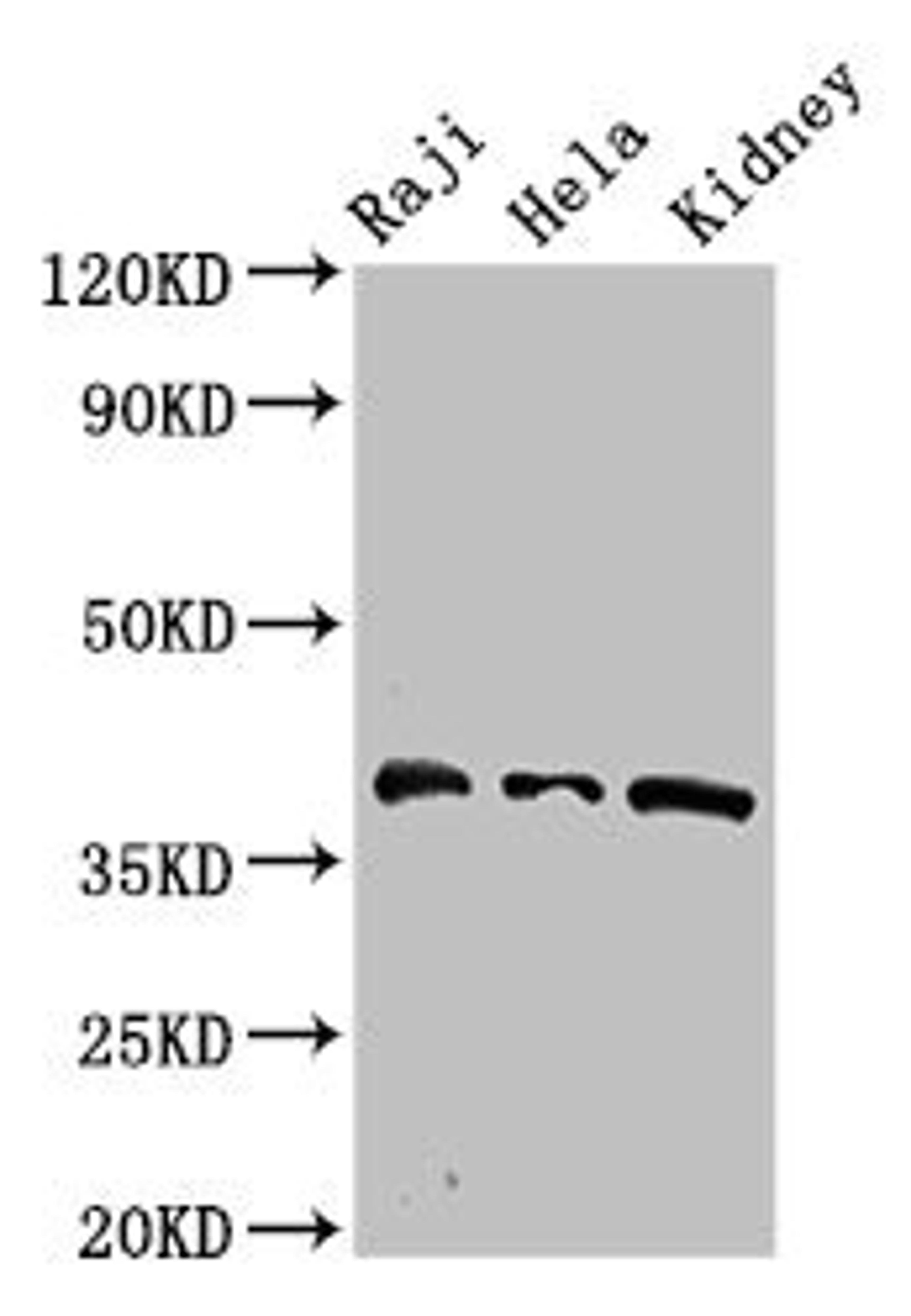 Western Blot. Positive WB detected in: Raji whole cell lysate, Hela whole cell lysate, Mouse kidney tissue. All lanes: RFC4 antibody at 2.7ug/ml. Secondary. Goat polyclonal to rabbit IgG at 1/50000 dilution. Predicted band size: 40, 34 kDa. Observed band size: 40 kDa. 