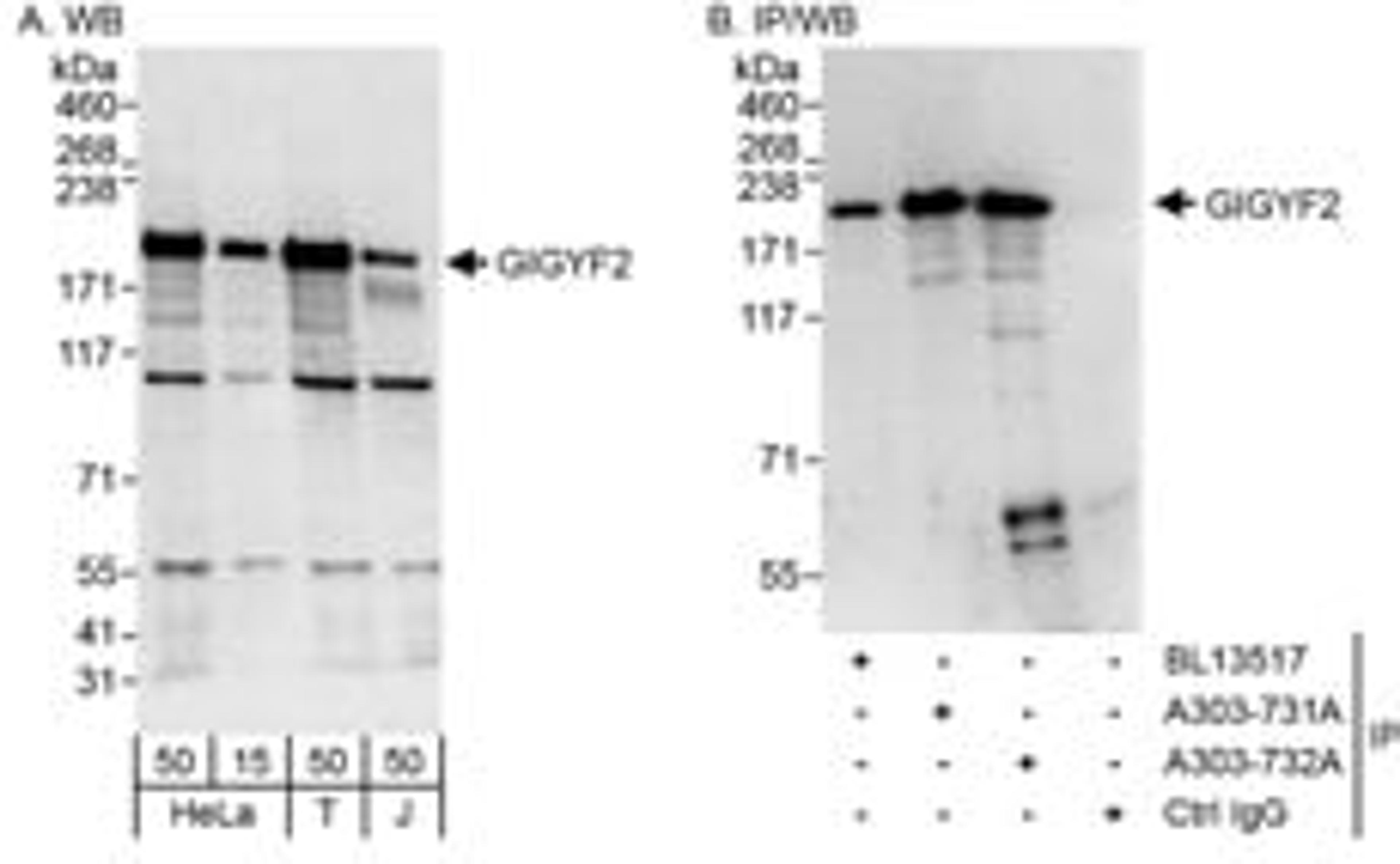 Detection of human GIGYF2 by western blot and immunoprecipitation.