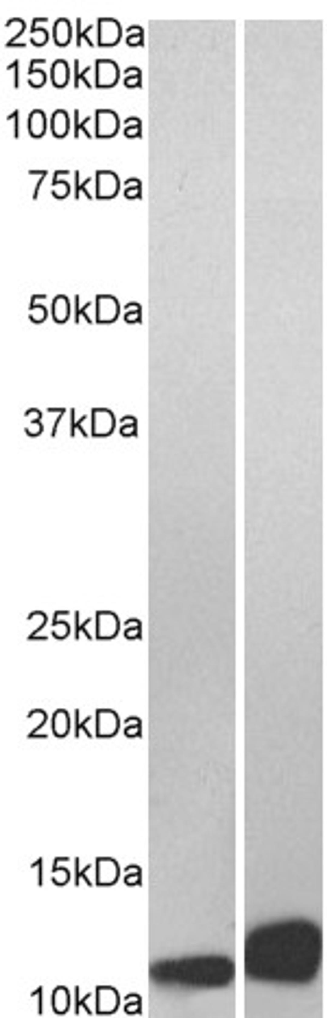 45-888 (0.01ug/ml) staining of Daudi (A) and Jurkat (B) lysate (35ug protein in RIPA buffer). Primary incubation was 1 hour. Detected by chemiluminescence.