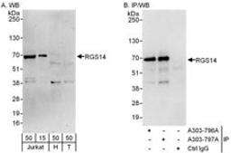 Detection of human RGS14 by western blot and immunoprecipitation.