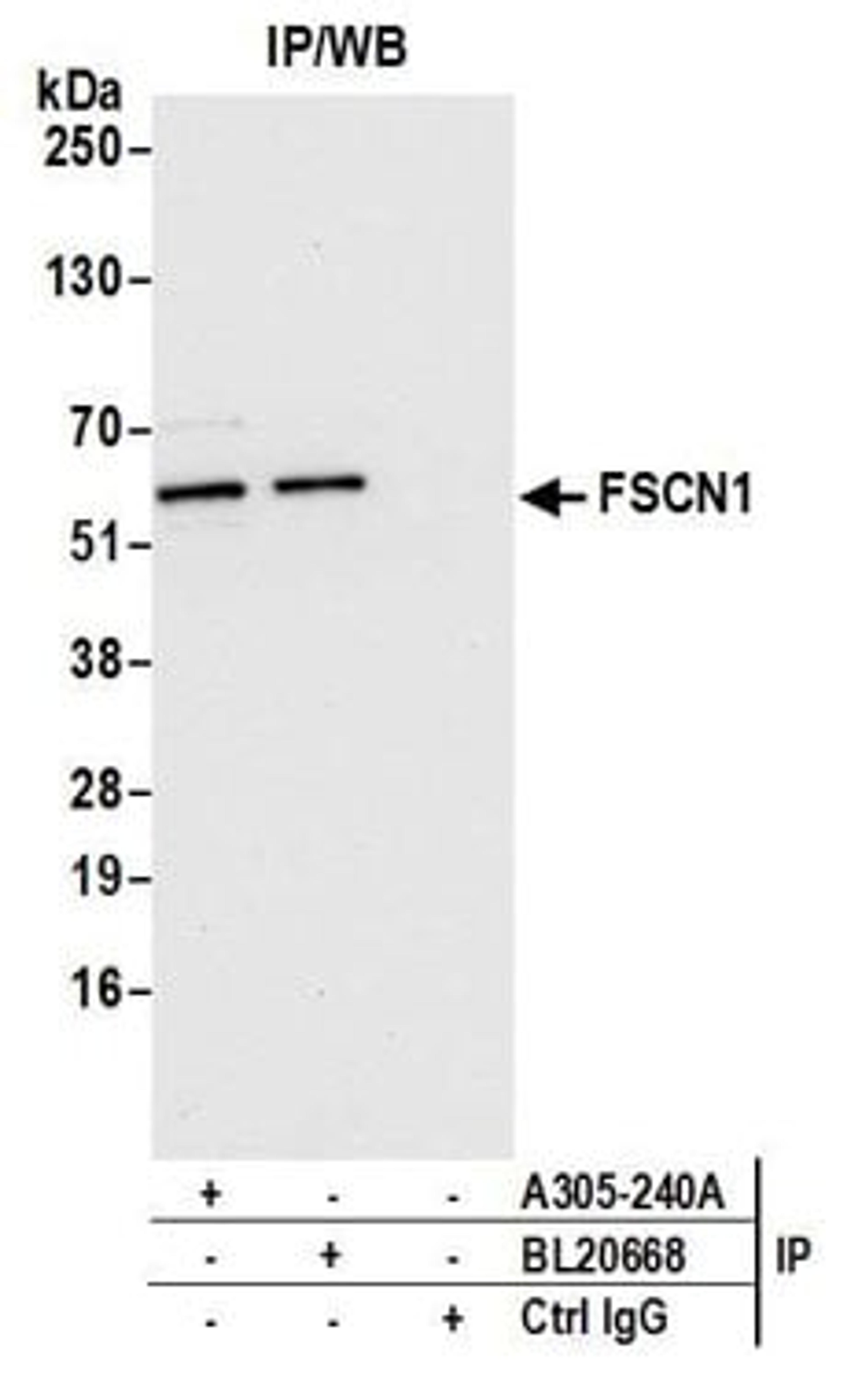 Detection of Human FSCN1 by western blot of immunoprecipitates.