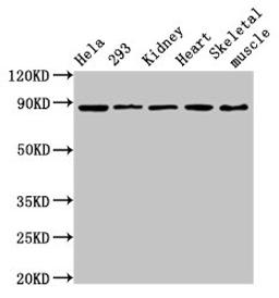 Western Blot. Positive WB detected in: Hela whole cell lysate, 293 whole cell lysate, Rat kidney tissue, Mouse heart tissue, Mouse skeletal muscle tissue. All lanes: SEMA3A antibody at 3.6µg/ml. Secondary. Goat polyclonal to rabbit IgG at 1/50000 dilution. Predicted band size: 89 kDa. Observed band size: 89 kDa