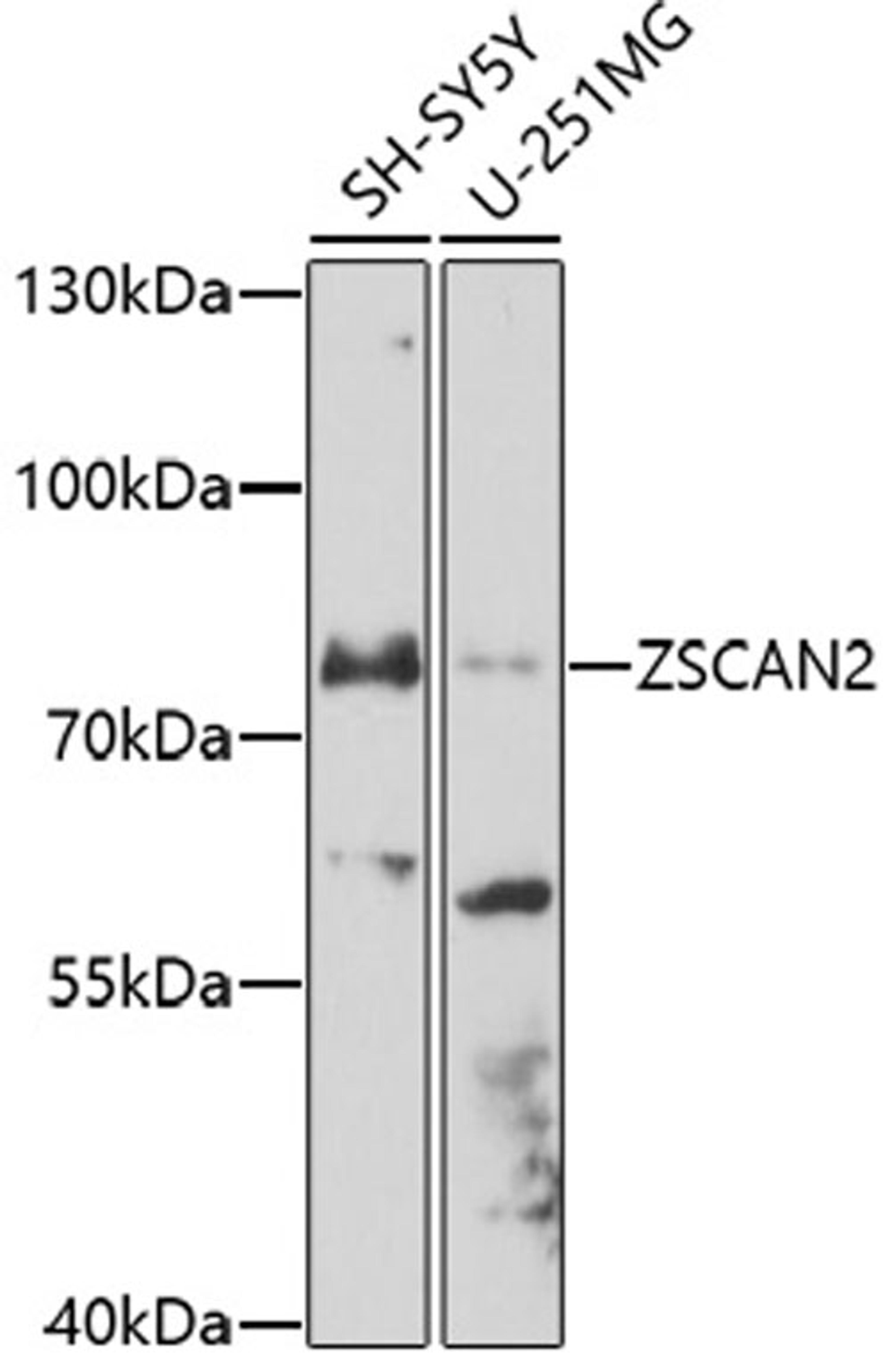 Western blot - ZSCAN2 antibody (A17173)