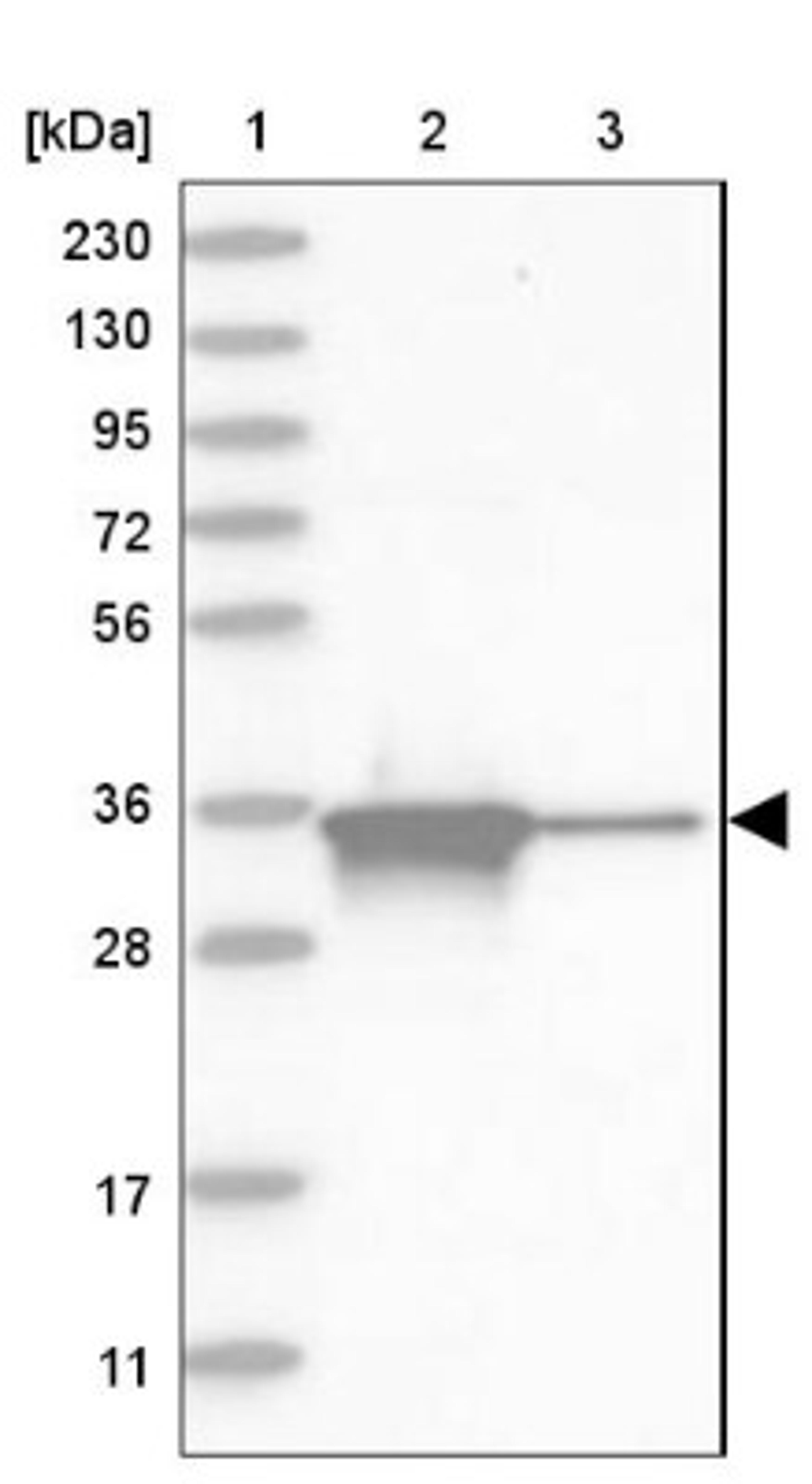 Western Blot: AKR1B1 Antibody [NBP1-89146] - Lane 1: Marker [kDa] 230, 130, 95, 72, 56, 36, 28, 17, 11<br/>Lane 2: Human cell line RT-4<br/>Lane 3: Human cell line U-251MG sp