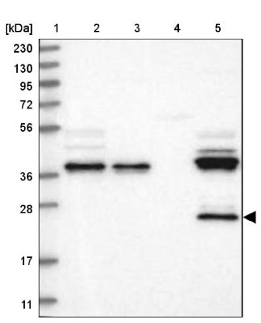 Western Blot: ZA20D3 Antibody [NBP1-90060] - Lane 1: Marker [kDa] 230, 130, 95, 72, 56, 36, 28, 17, 11<br/>Lane 2: Human cell line RT-4<br/>Lane 3: Human cell line U-251MG sp<br/>Lane 4: Human plasma (IgG/HSA depleted)<br/>Lane 5: Human liver tissue