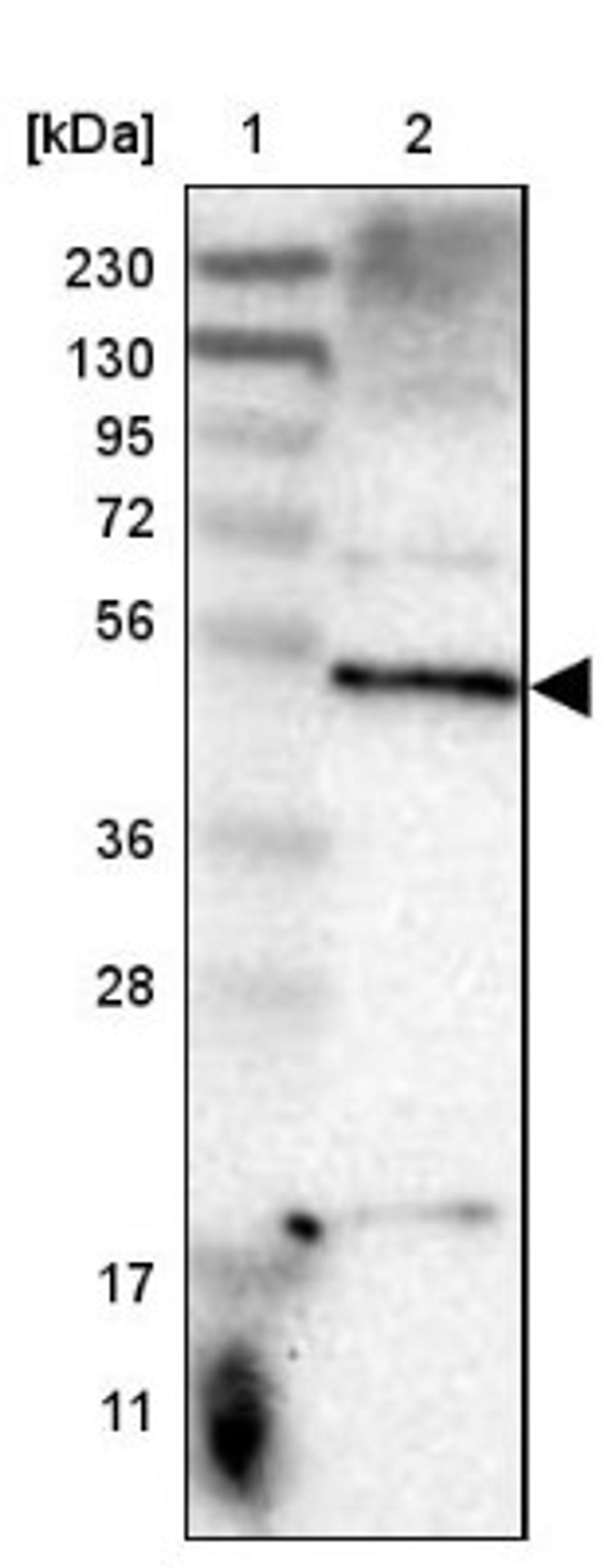 Immunohistochemistry: SNX30 Antibody [NBP1-90841] - Lane 1: Marker [kDa] 230, 130, 95, 72, 56, 36, 28, 17, 11<br/>Lane 2: Human cell line RT-4