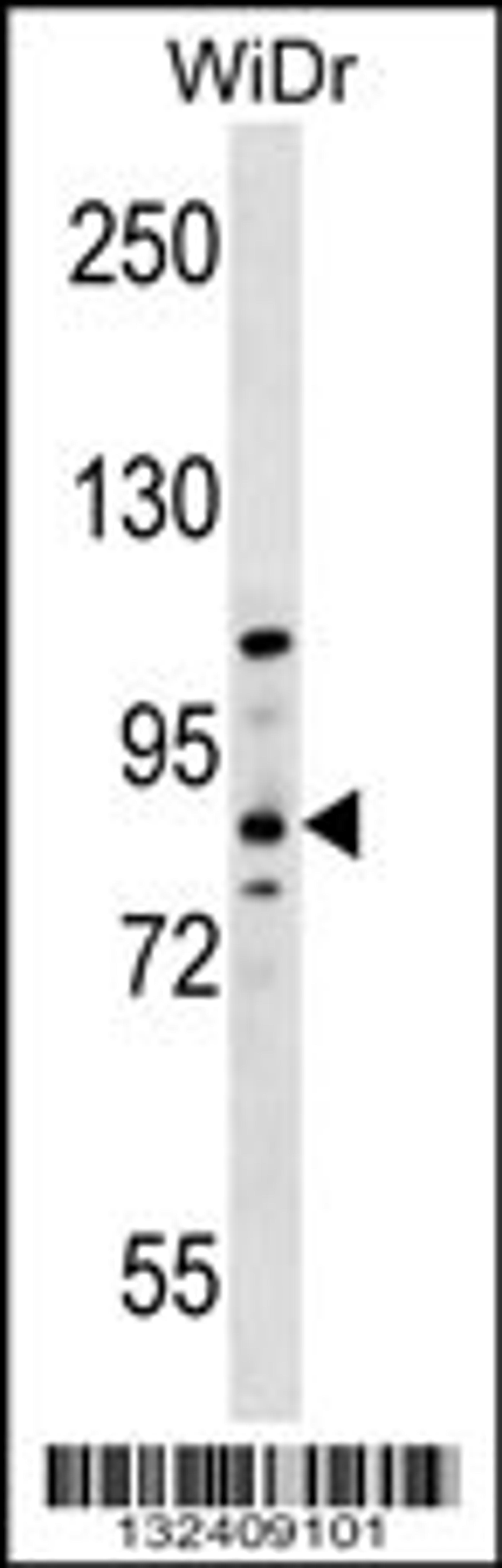 Western blot analysis in WiDr cell line lysates (35ug/lane).