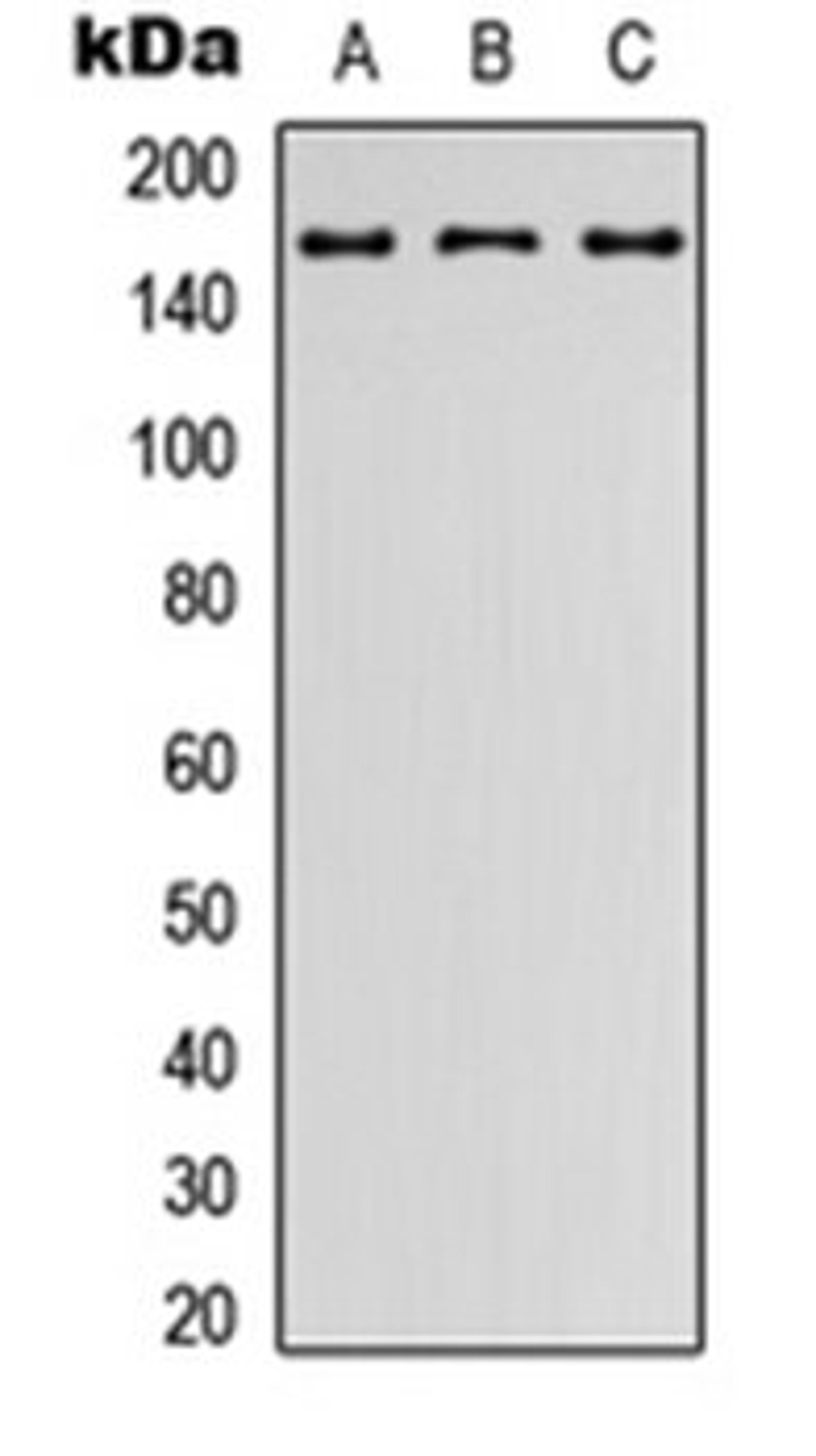 Western blot analysis of HEK293T (Lane 1), Raw264.7 (Lane 2), PC12 (Lane 3) whole cell lysates using LPHN2 antibody