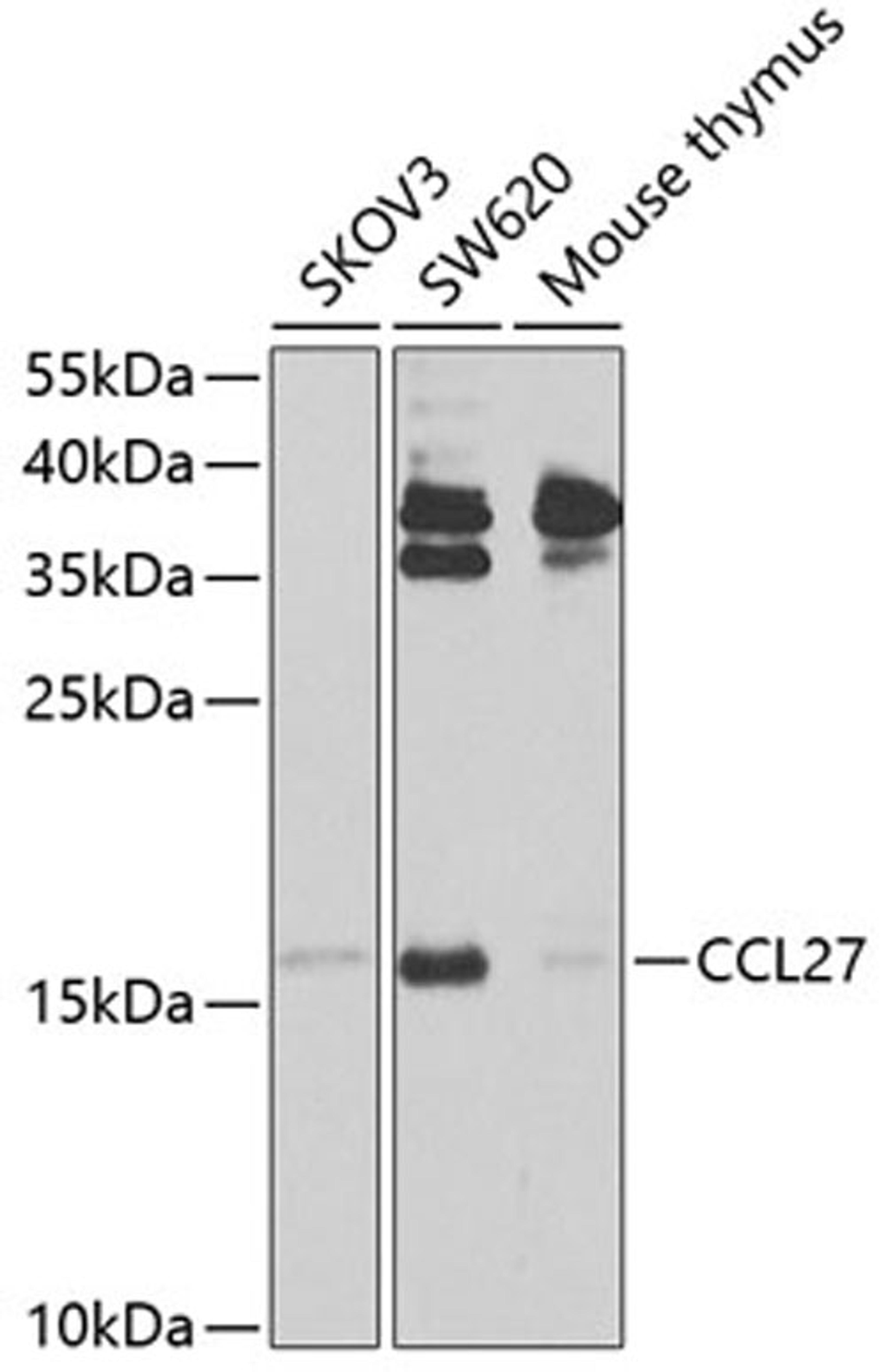 Western blot - CCL27 antibody (A9864)