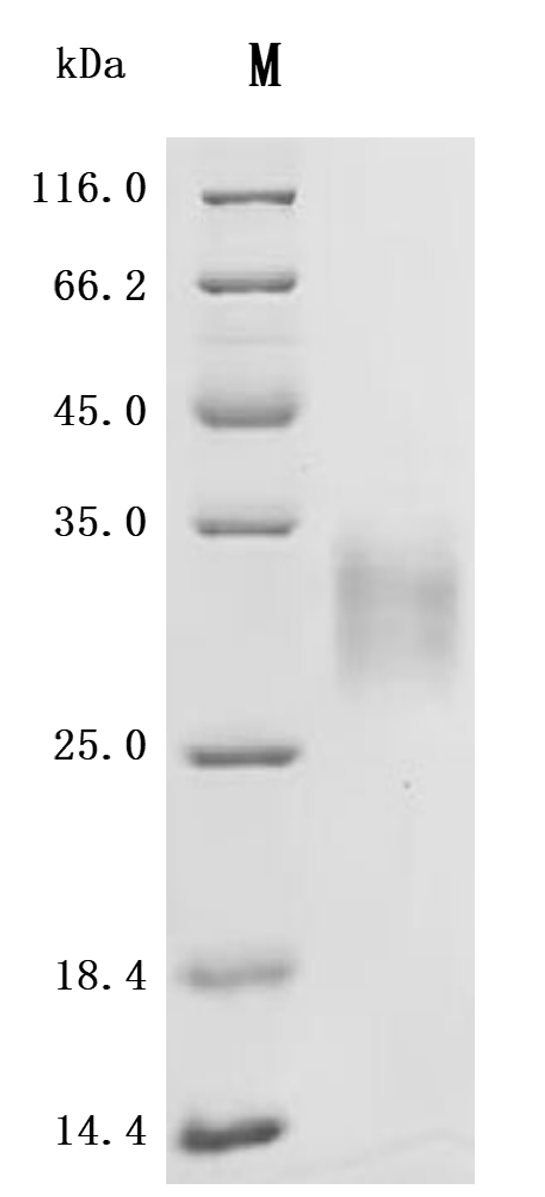 (Tris-Glycine gel) Discontinuous SDS-PAGE (reduced) with 5% enrichment gel and 15% separation gel.