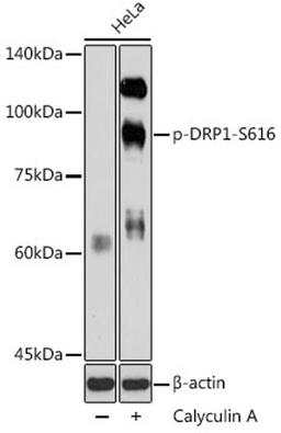 Western blot - Phospho-DRP1-S616 antibody (AP0849)