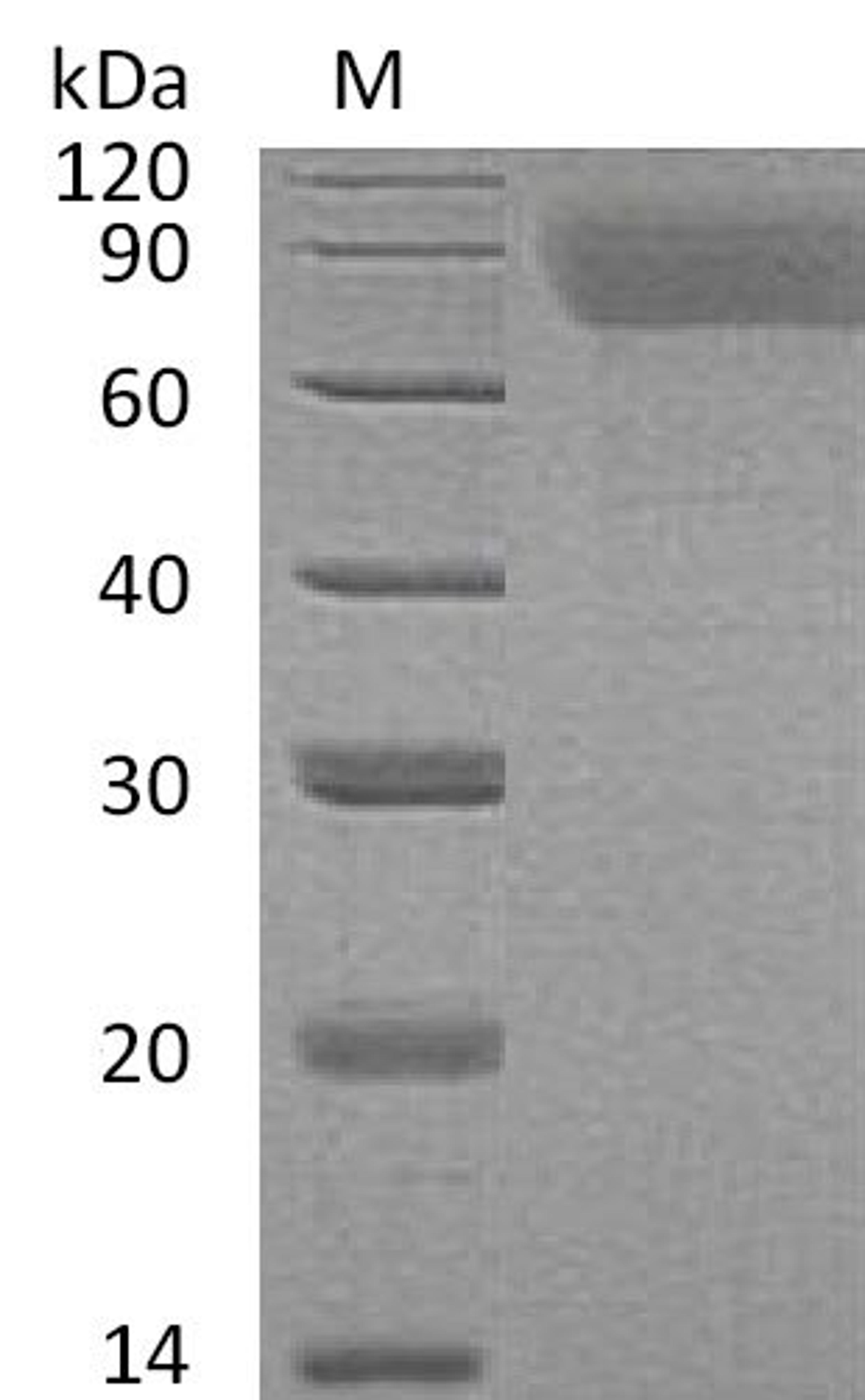 (Tris-Glycine gel) Discontinuous SDS-PAGE (reduced) with 5% enrichment gel and 15% separation gel.