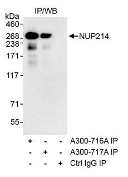 Detection of human NUP214 by western blot of immunoprecipitates.