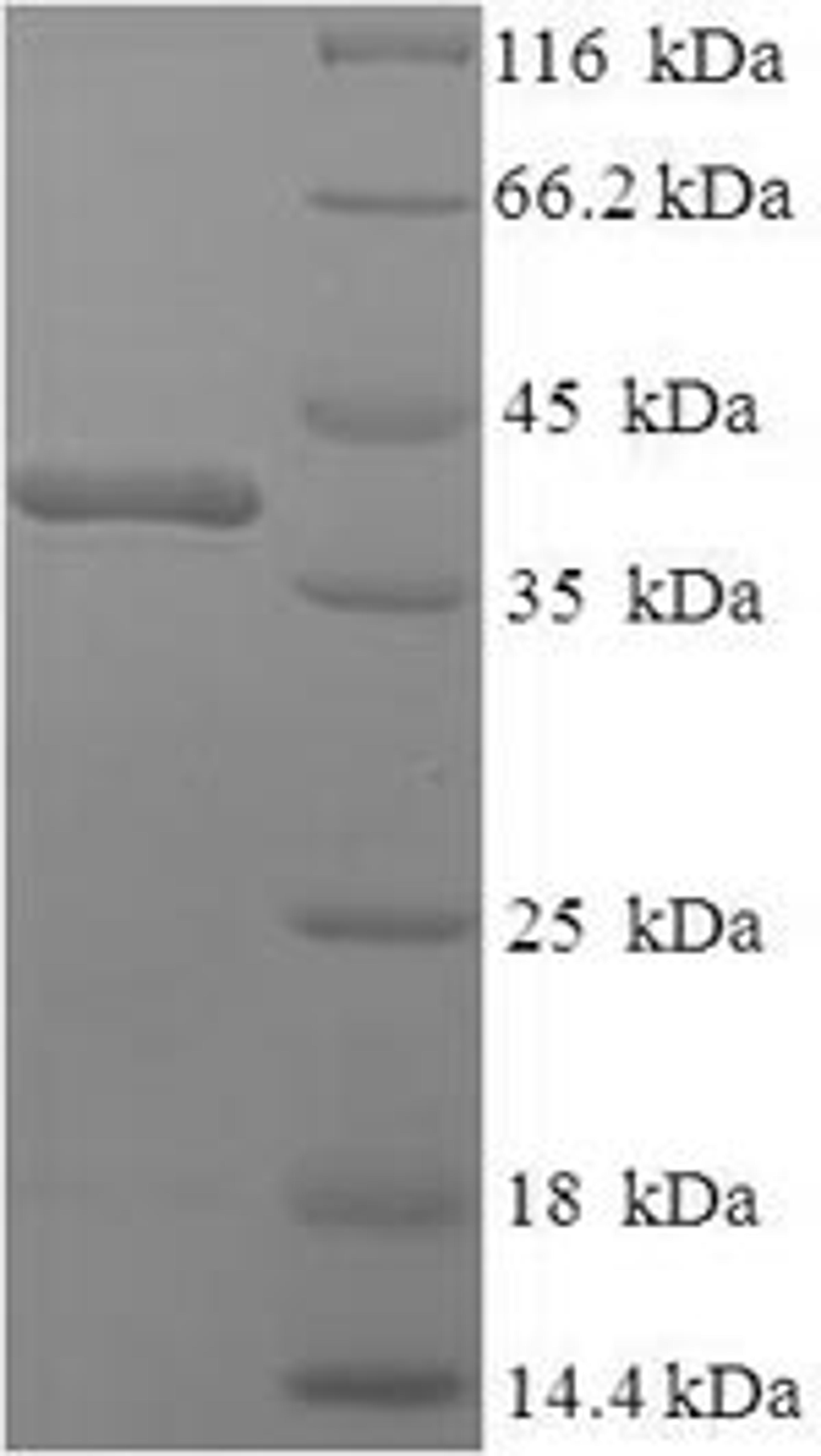 (Tris-Glycine gel) Discontinuous SDS-PAGE (reduced) with 5% enrichment gel and 15% separation gel.