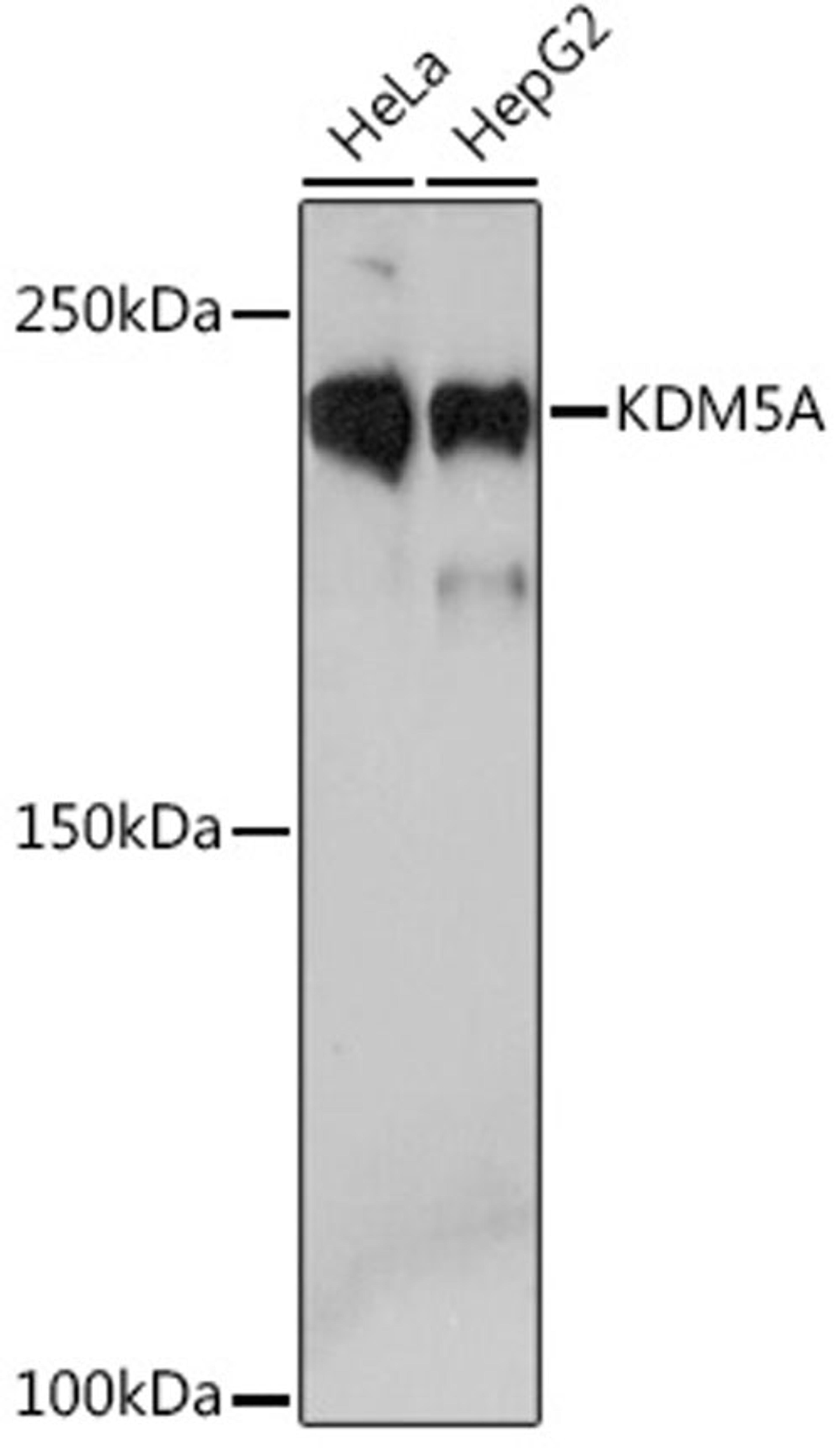 Western blot - KDM5A Rabbit mAb (A4755)