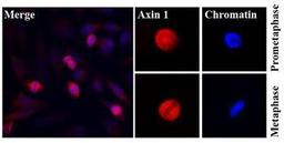 Immunocytochemistry/Immunofluorescence: Axin 1 Antibody (AT1A4) [NBP1-74031] - Immunofluorescence of stained human HeLa cells was done with Hoechst 33342 (Blue) for chromatin staining and Texas Red (Red) for monoclonal anti-human Axin1a antibody (1:500).