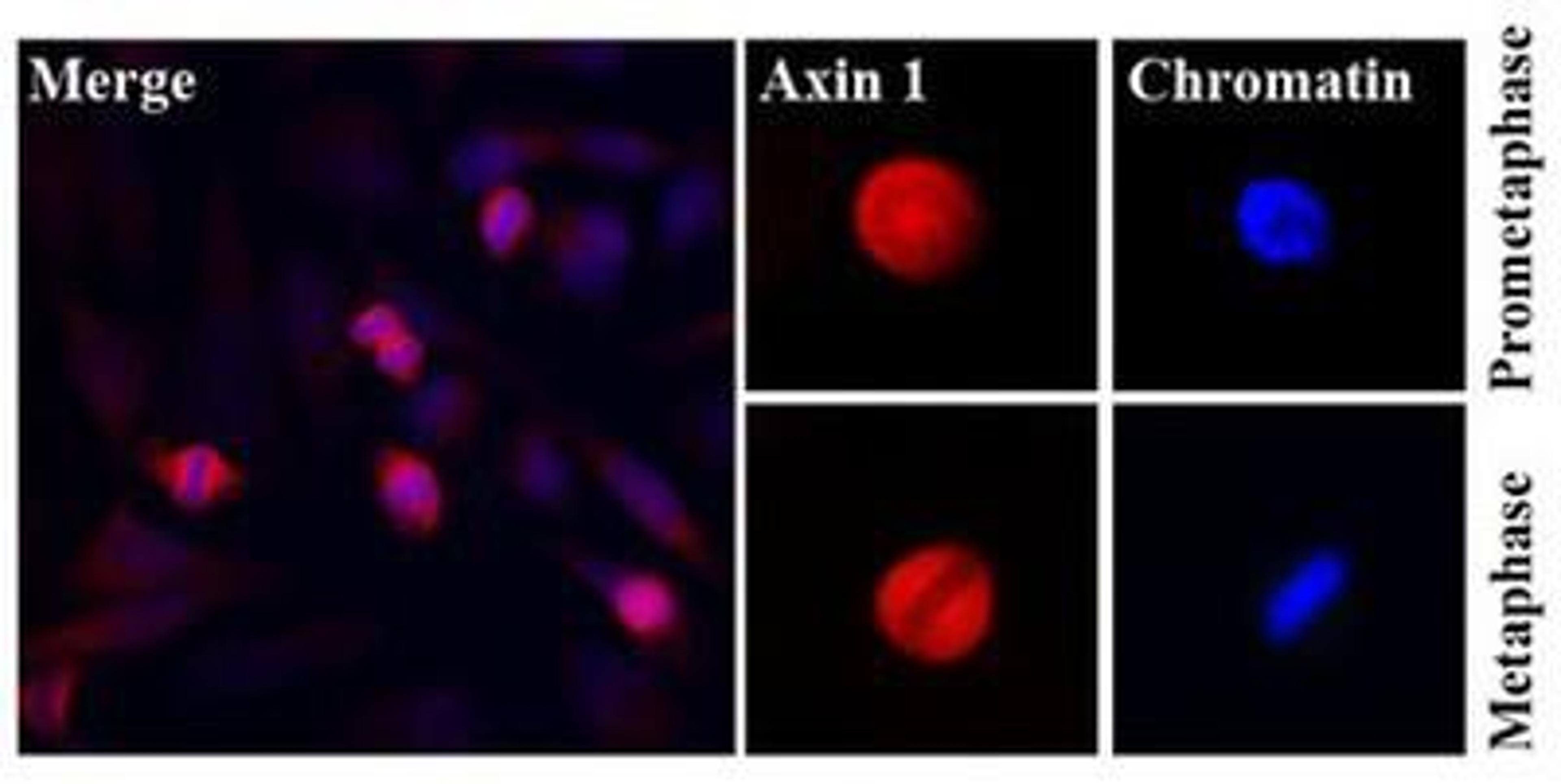 Immunocytochemistry/Immunofluorescence: Axin 1 Antibody (AT1A4) [NBP1-74031] - Immunofluorescence of stained human HeLa cells was done with Hoechst 33342 (Blue) for chromatin staining and Texas Red (Red) for monoclonal anti-human Axin1a antibody (1:500).