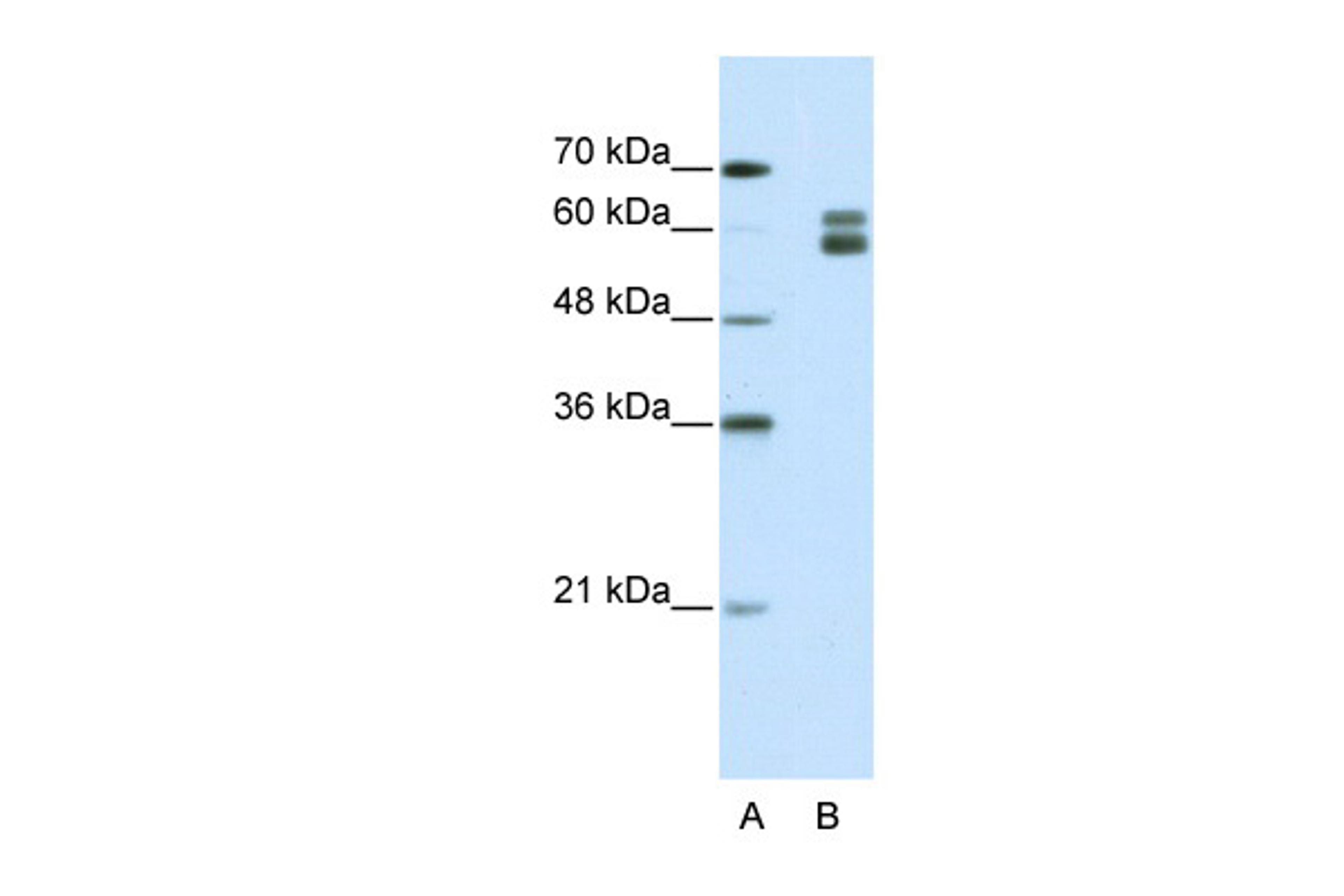 Antibody used in WB on Human HepG2 at 1.25 ug/ml.