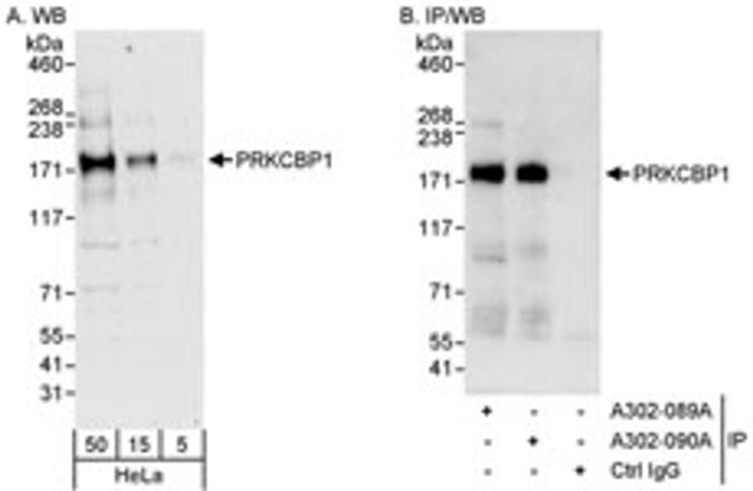 Detection of human PRKCBP1 by western blot and immunoprecipitation.