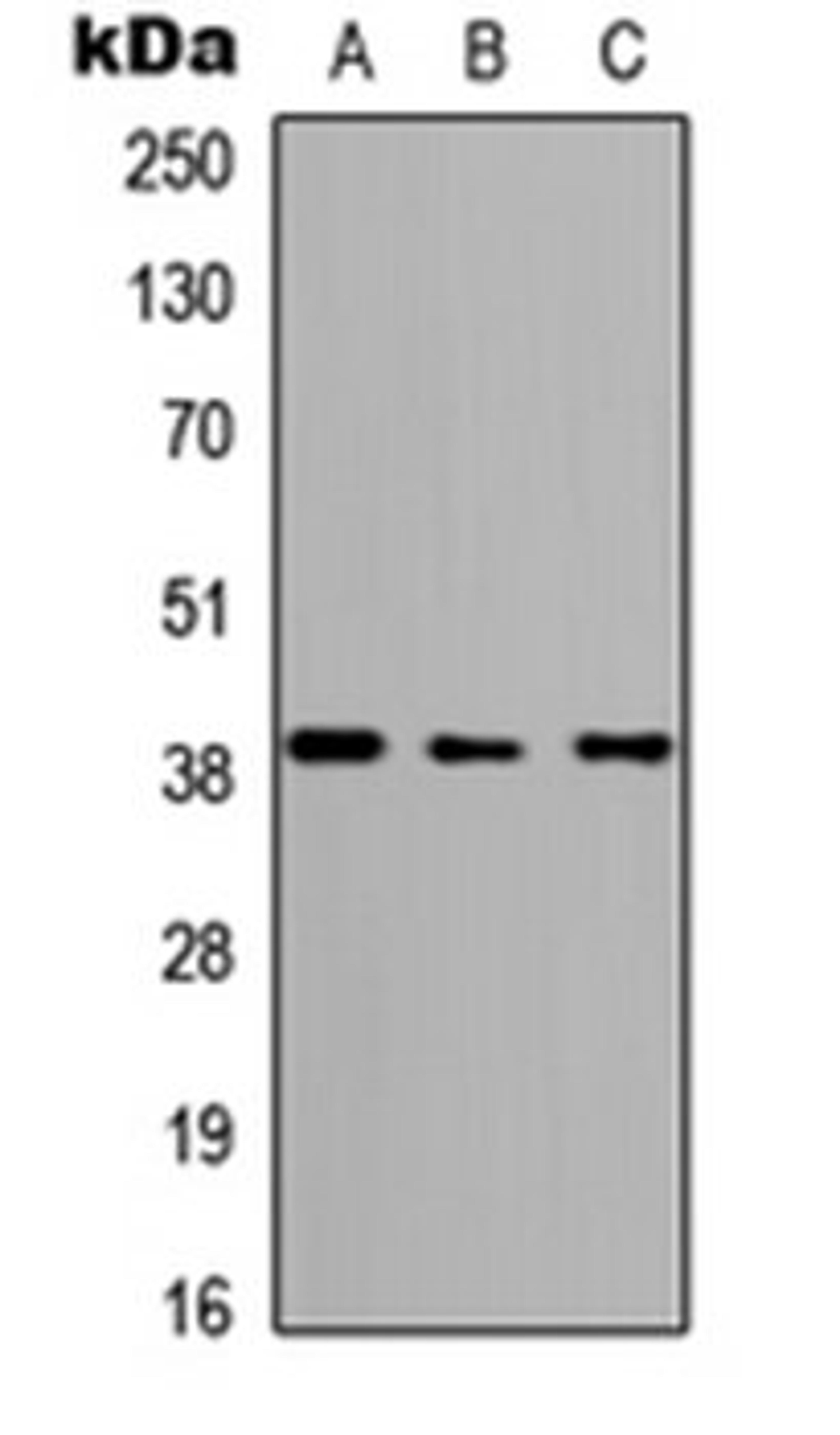 Western blot analysis of HEK293T (Lane 1), Raw264.7 (Lane 2), H9C2 (Lane 3) whole cell lysates using ABHD4 antibody