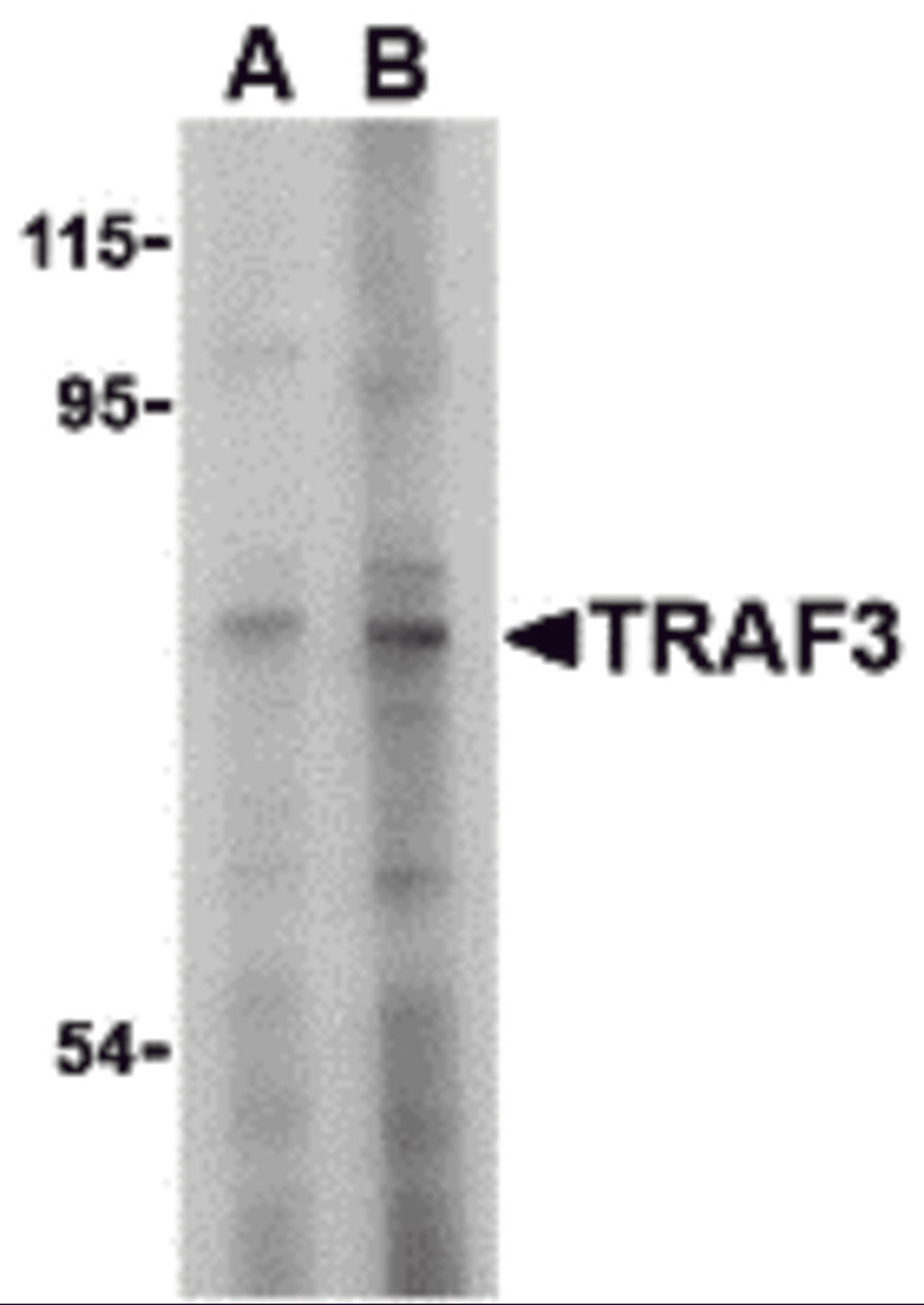 Western blot analysis of TRAF3 in HeLa cell lysate with TRAF3 antibody at (A) 2 and (B) 4 &#956;g/mL. 