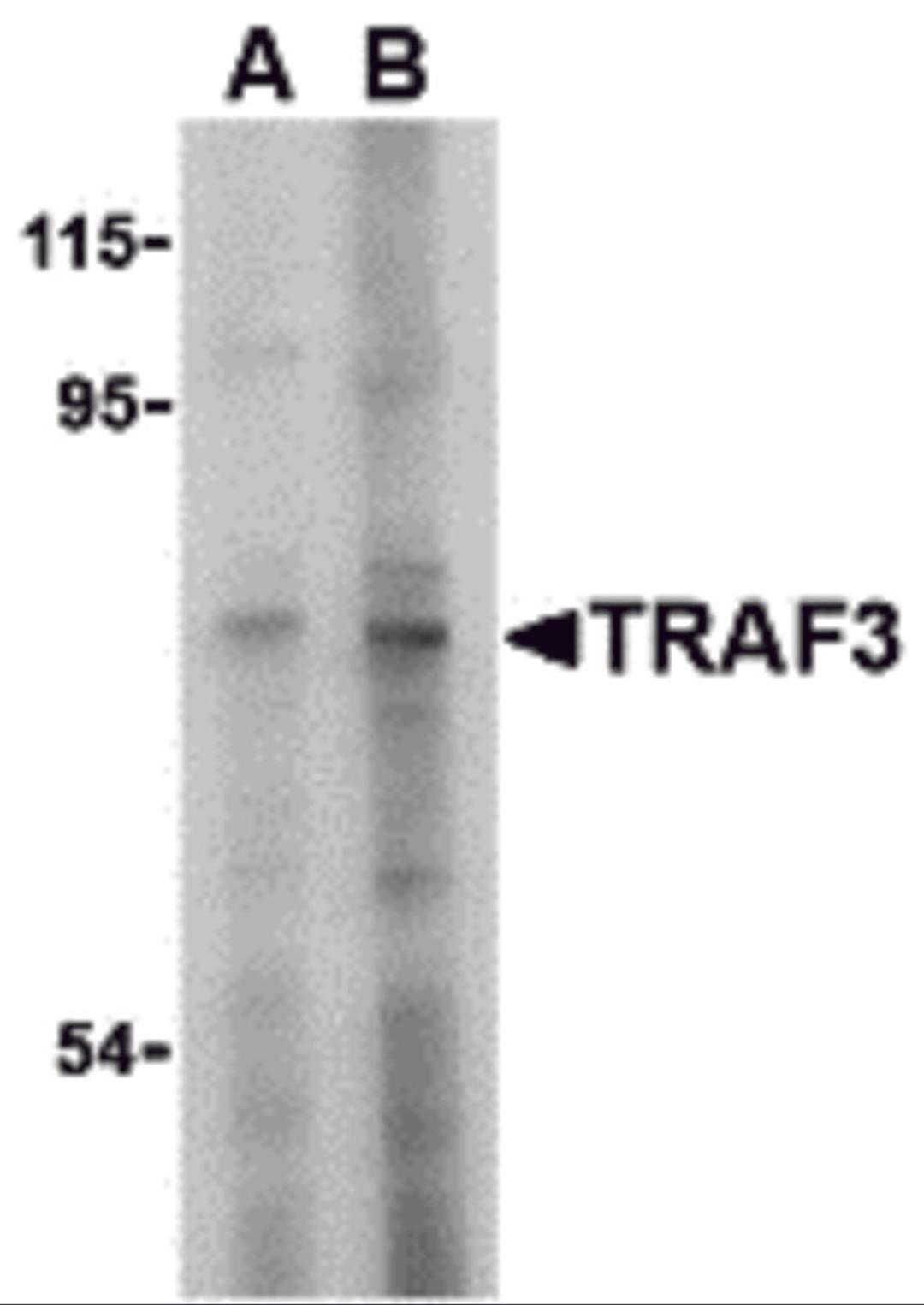 Western blot analysis of TRAF3 in HeLa cell lysate with TRAF3 antibody at (A) 2 and (B) 4 μg/mL.