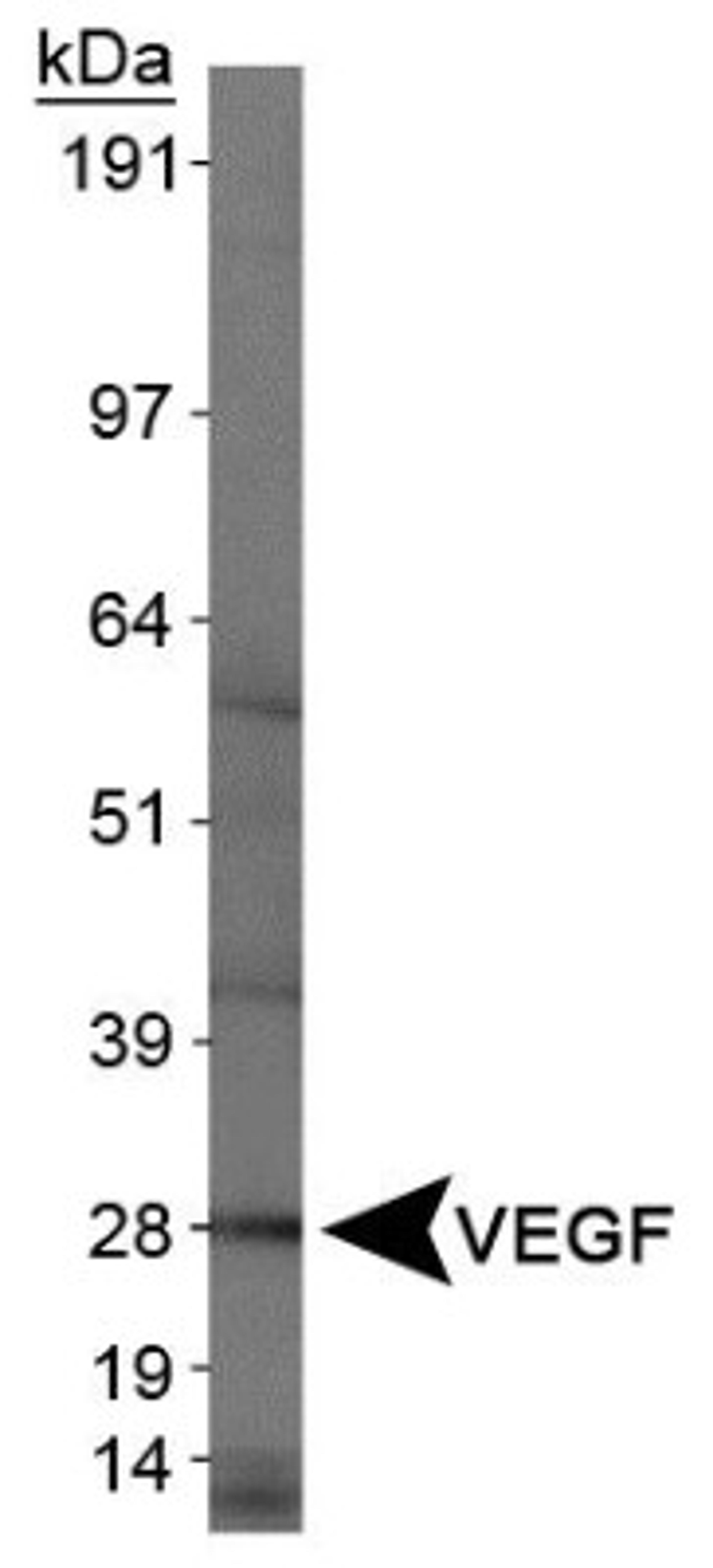 Western Blot: VEGF Antibody (VG1) [NB100-664] - Western blot analysis of VEGF in human kidney protein using NB100-664.