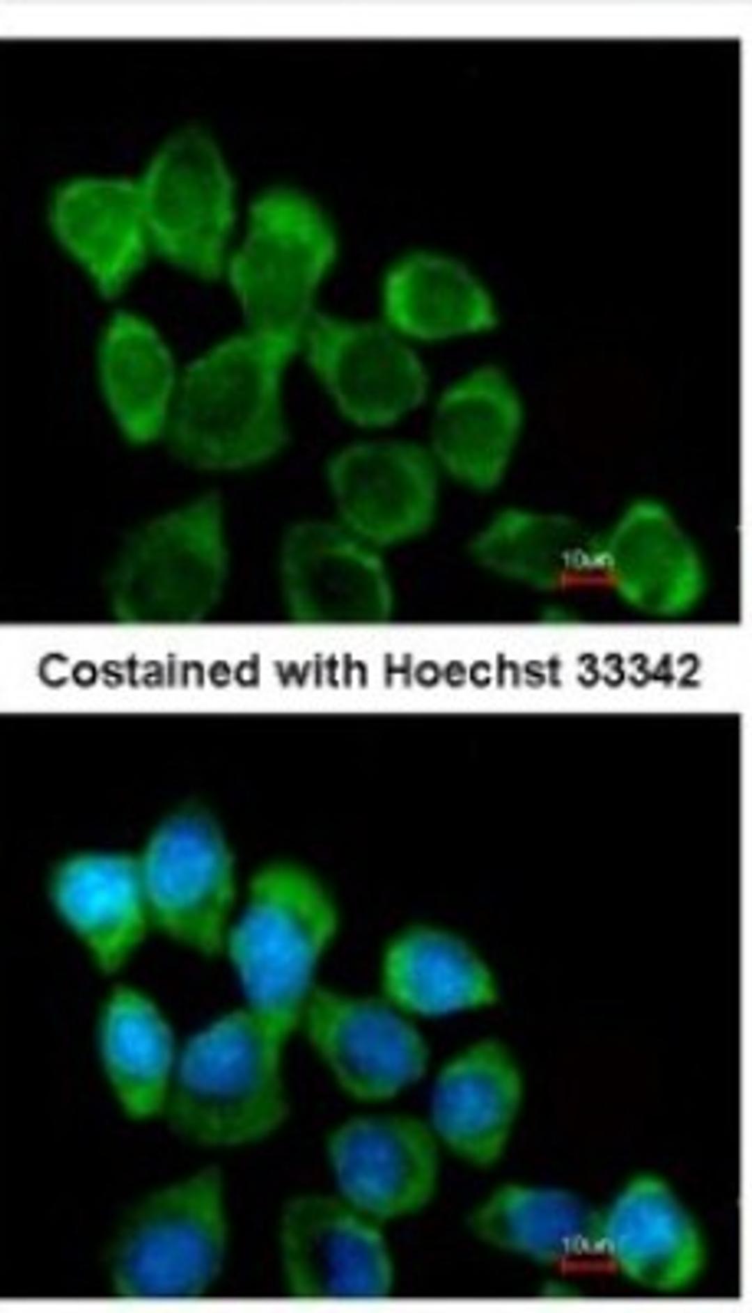 Immunocytochemistry/Immunofluorescence: Involucrin Antibody [NBP2-16981] - Analysis of methanol-fixed A431, using antibody at 1:200 dilution.