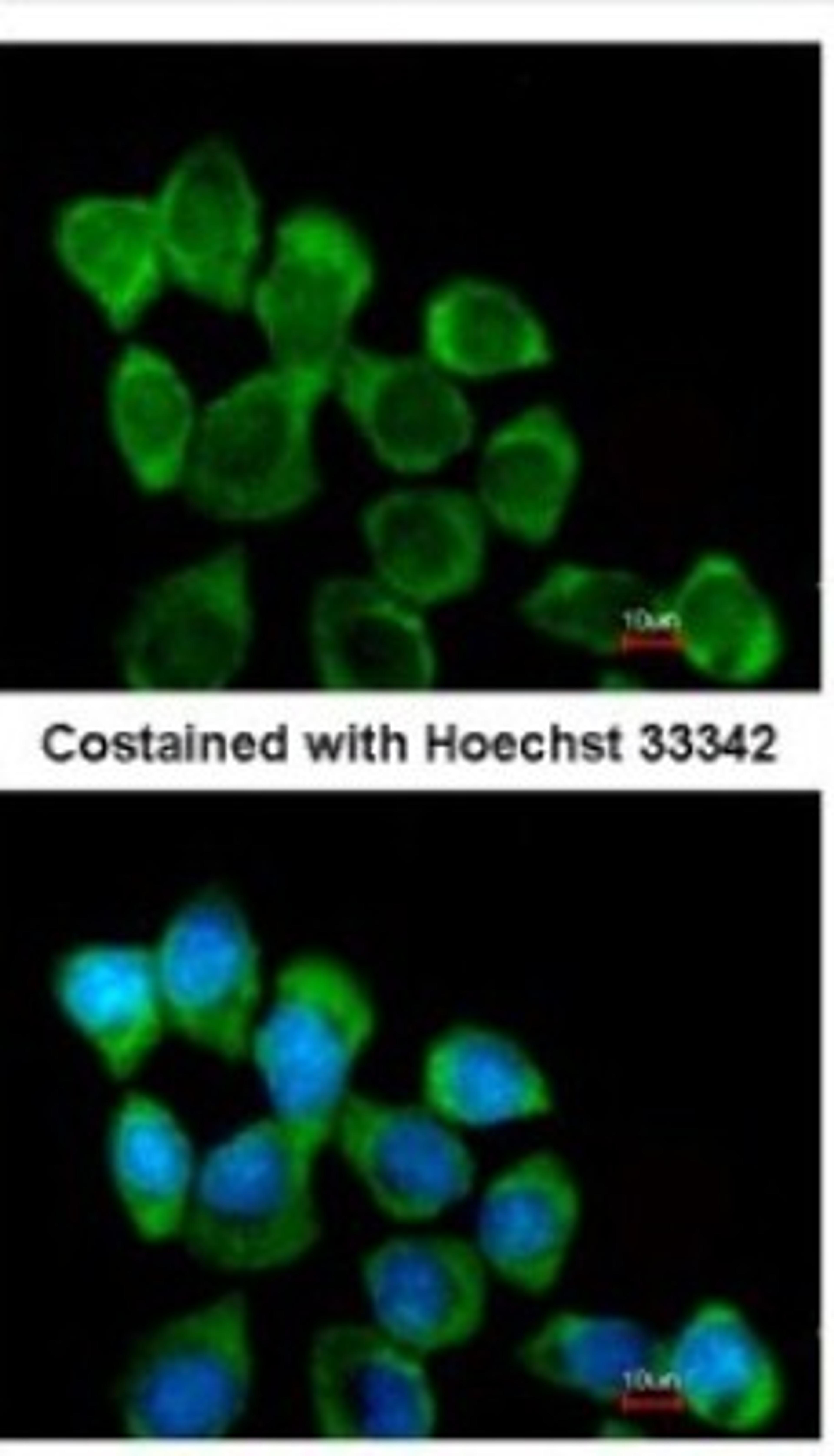 Immunocytochemistry/Immunofluorescence: Involucrin Antibody [NBP2-16981] - Analysis of methanol-fixed A431, using antibody at 1:200 dilution.