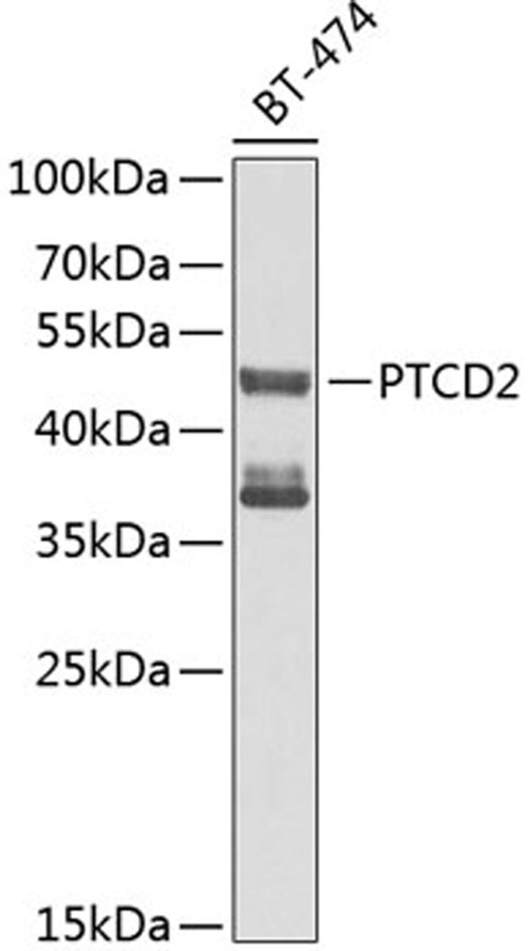 Western blot - PTCD2 antibody (A9982)