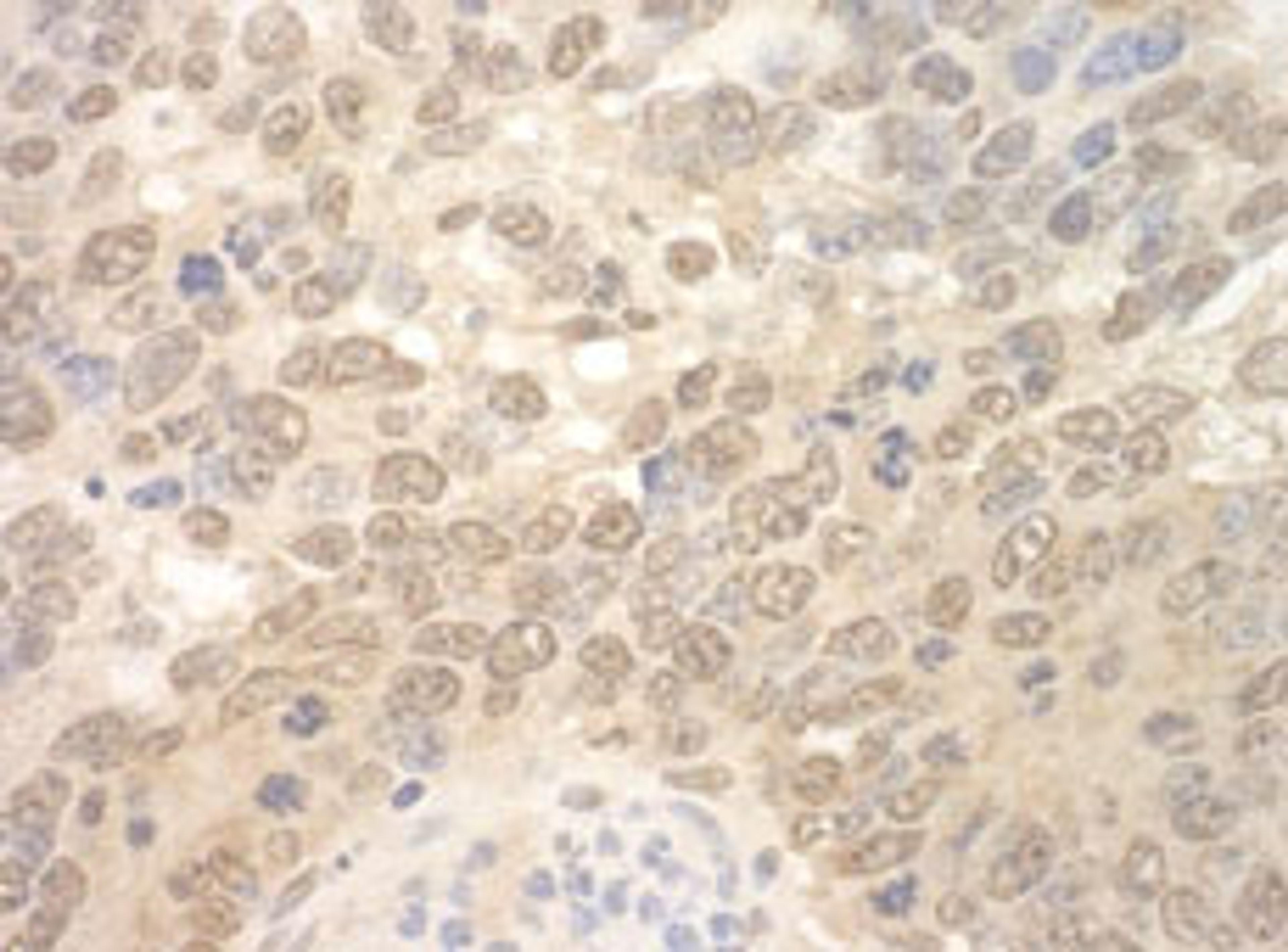 Detection of mouse SPF45 by immunohistochemistry.