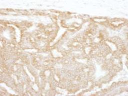 Detection of human GPI by immunohistochemistry.