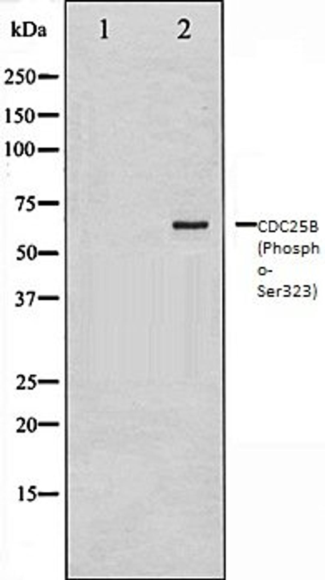 Western blot analysis of NIH-3T3 whole cell lysates using CDC25B (Phospho-Ser323) antibody, The lane on the left is treated with the antigen-specific peptide.